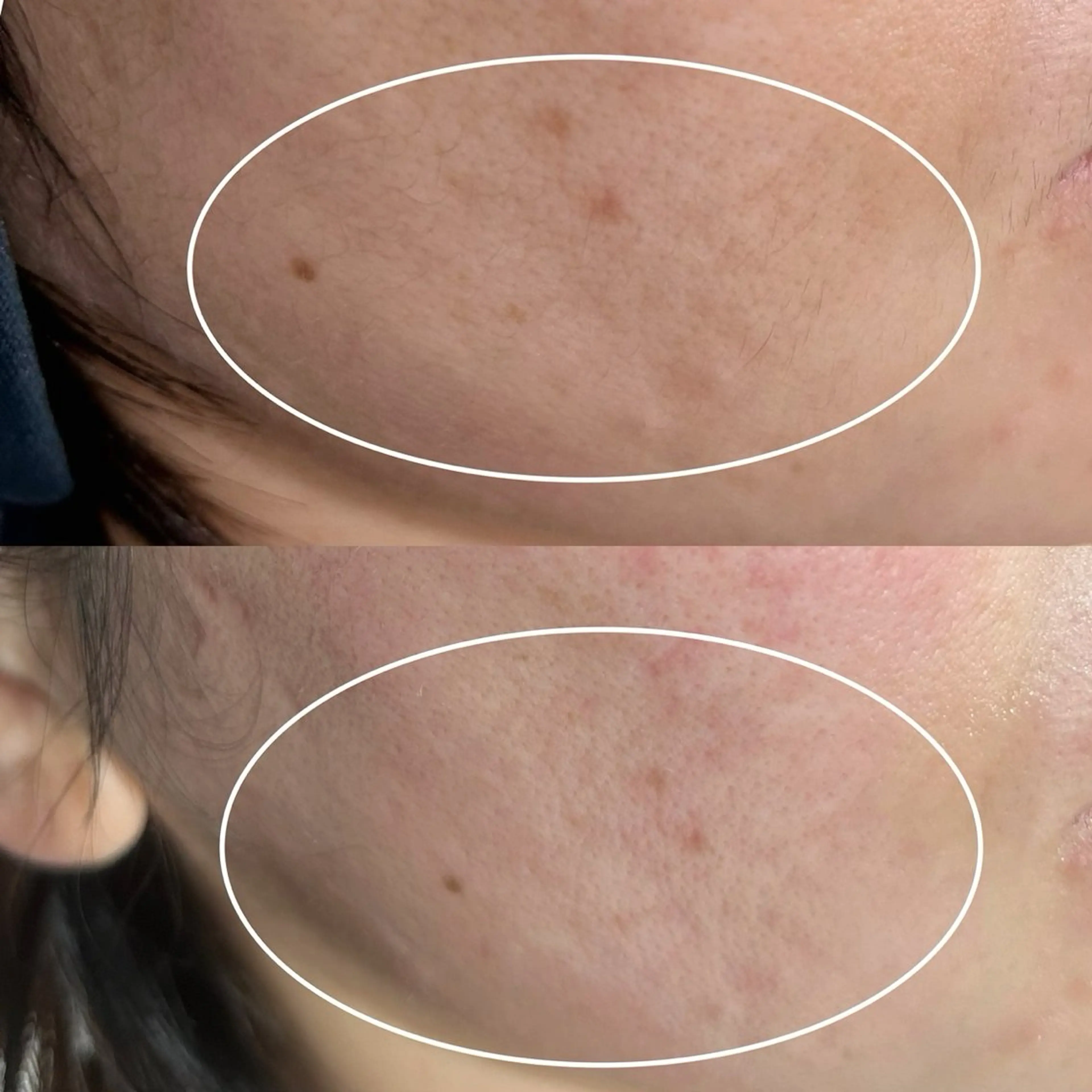 フェイシャルワックスの写真