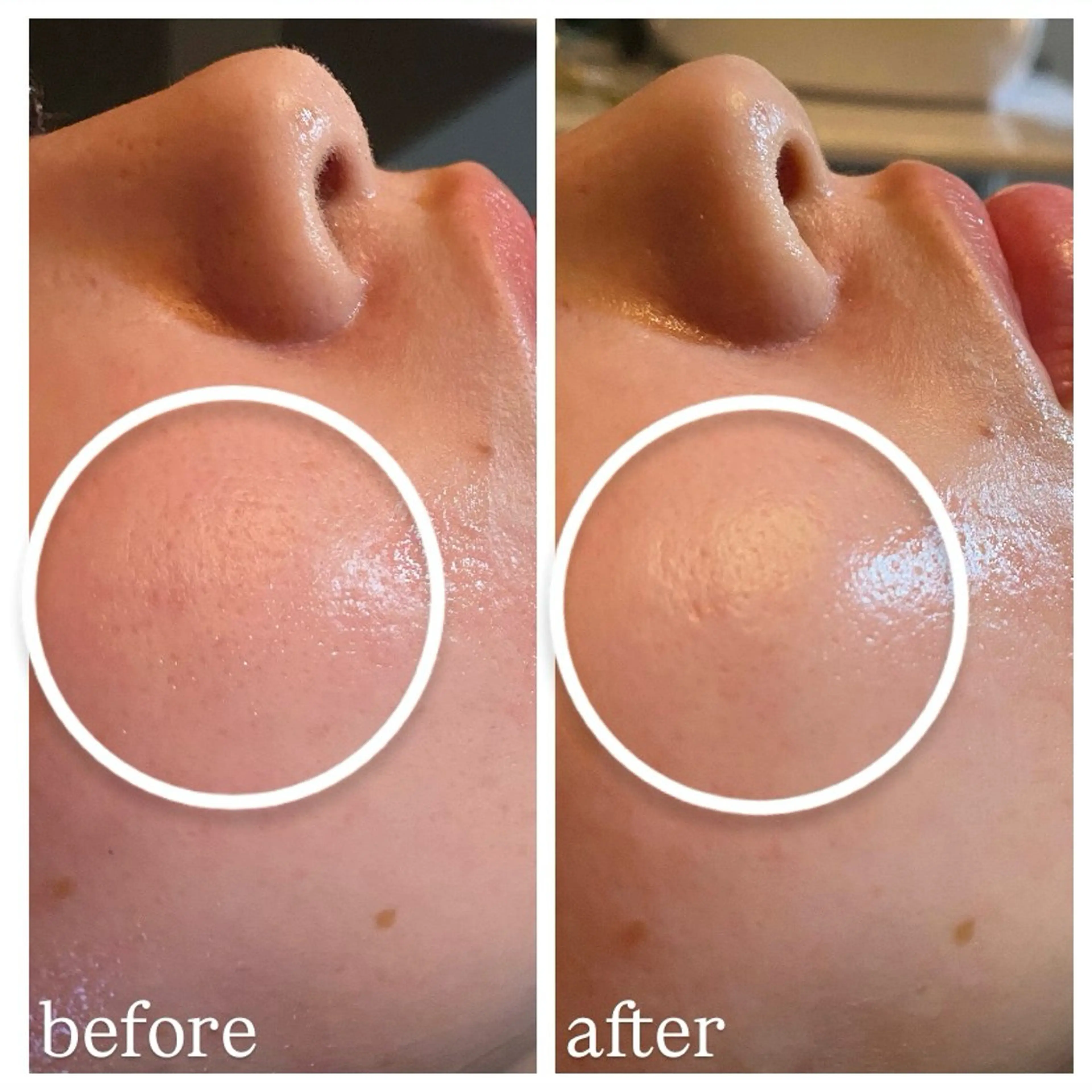 エステ 肌質改善専門 ハーブ /毛穴洗浄 リエイトのエステ・リラクイメージ