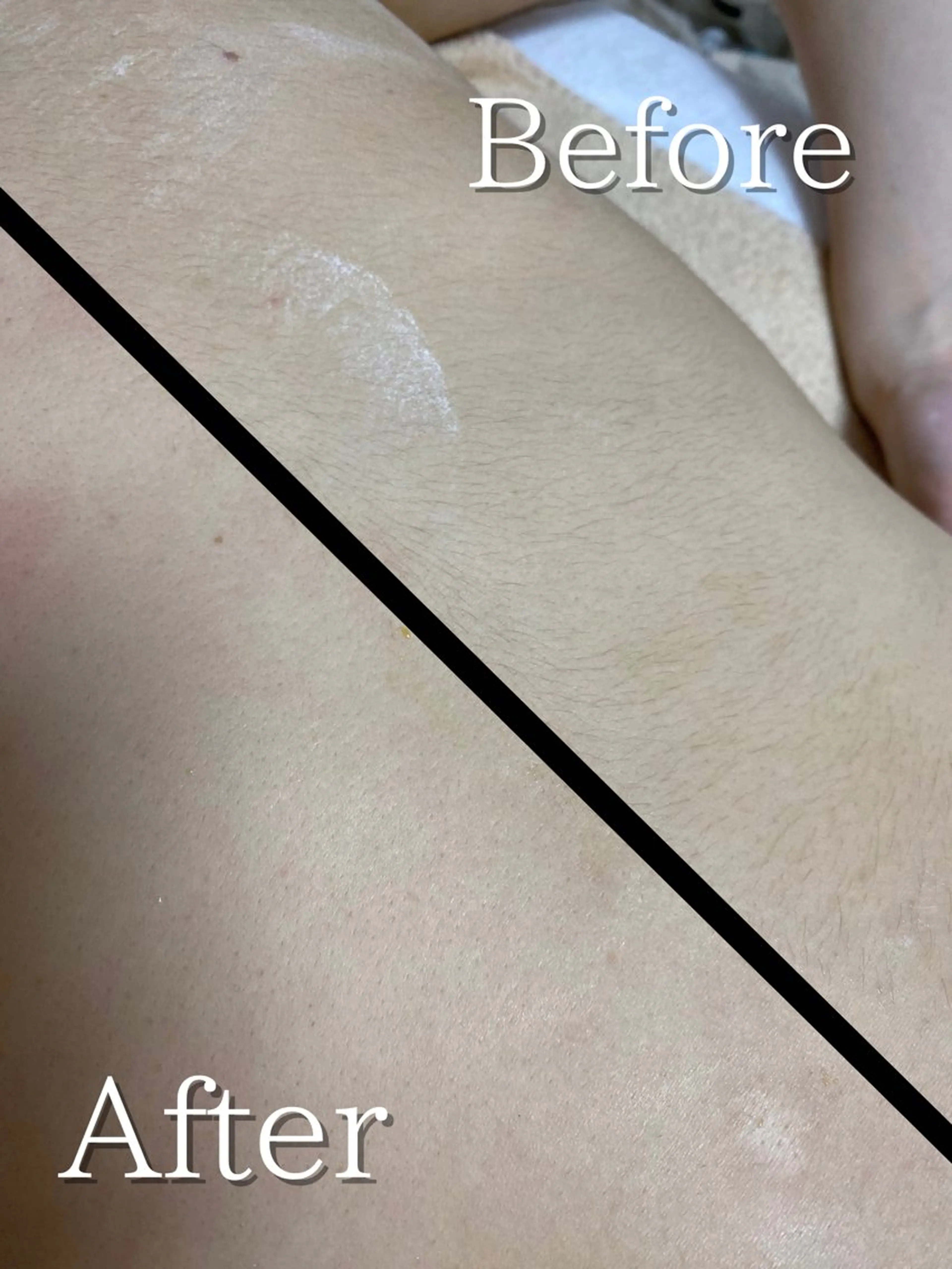 マツエク・マツパ 脱毛 シュガーリング脱毛 専門店Ranunのエステ・リラクイメージ