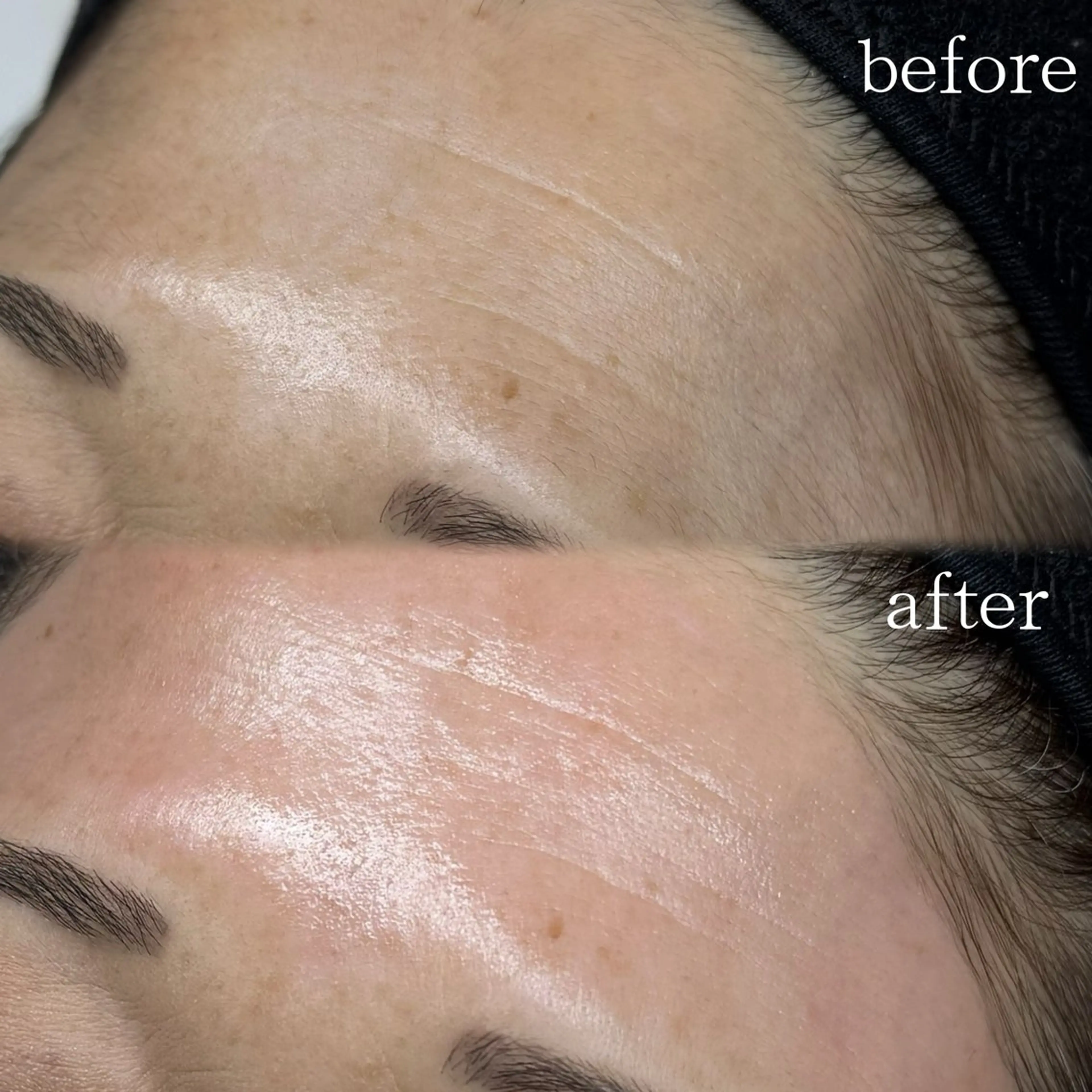 アイブロウ 脱毛 WHITEEYE堺東 店長/藁粥　明の眉毛・アイブロウイメージ