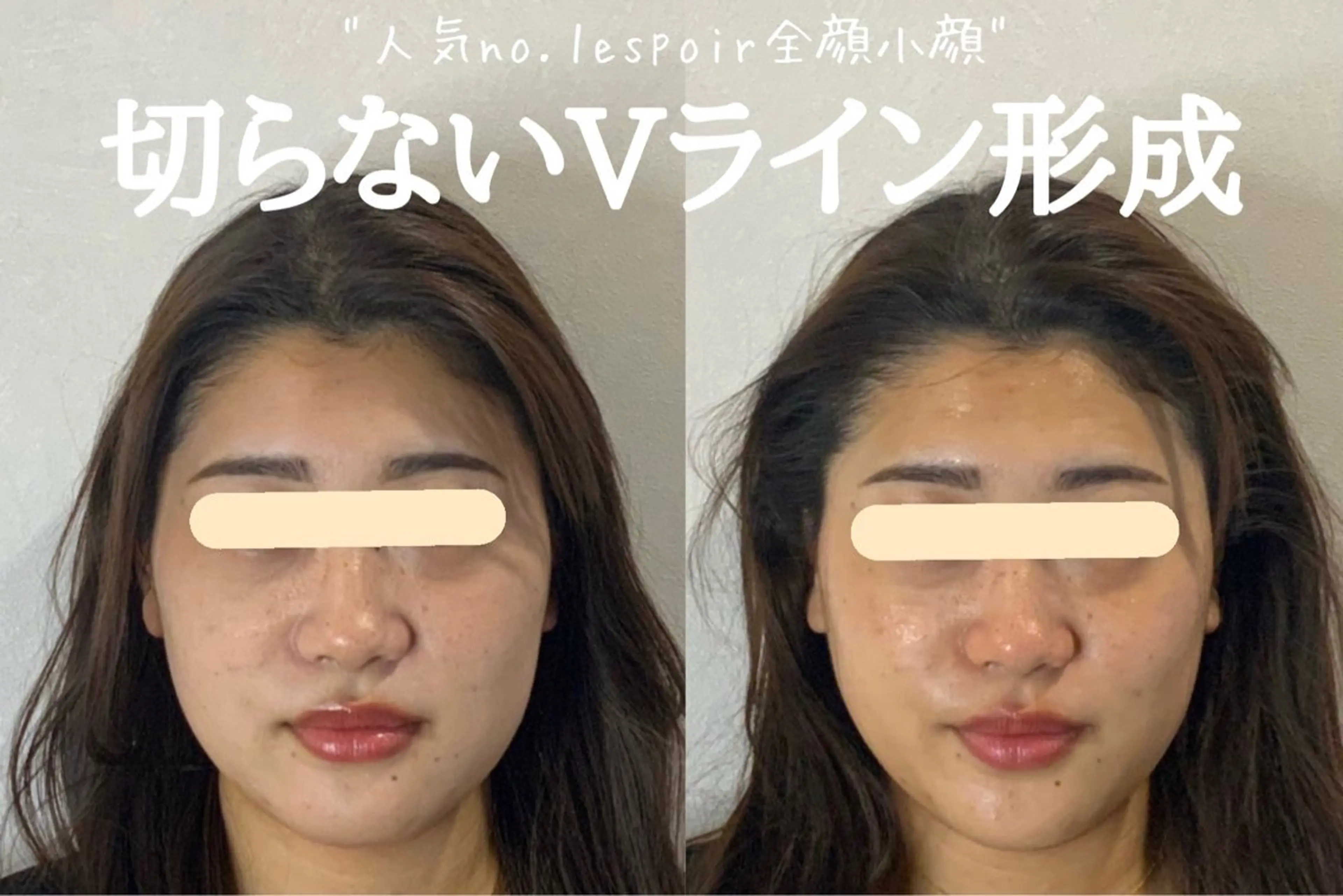 最速小顔・肌質管理 espoirマキのエステ・リラクイメージ