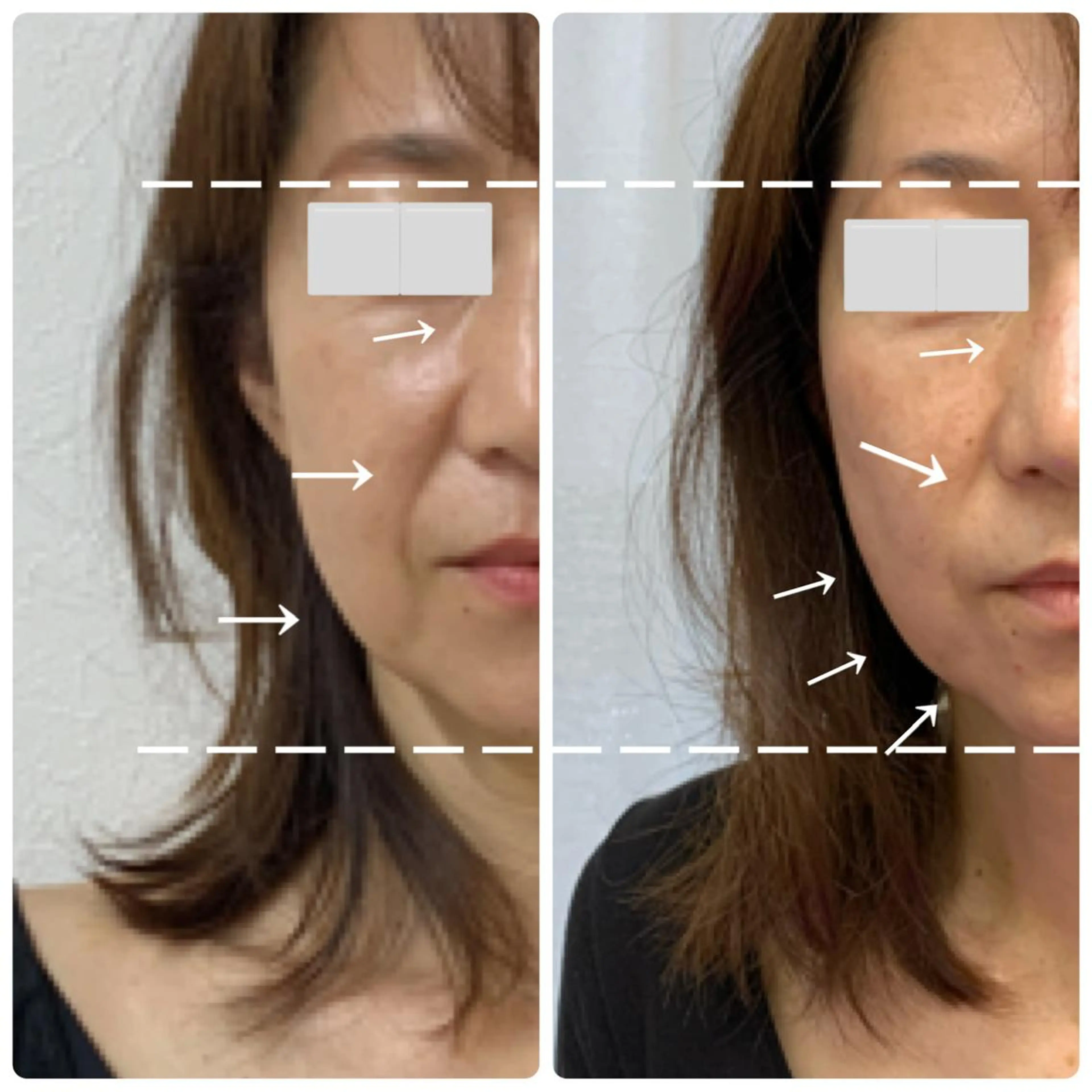 Natsu ＊メンズネイリストのネイルデザイン