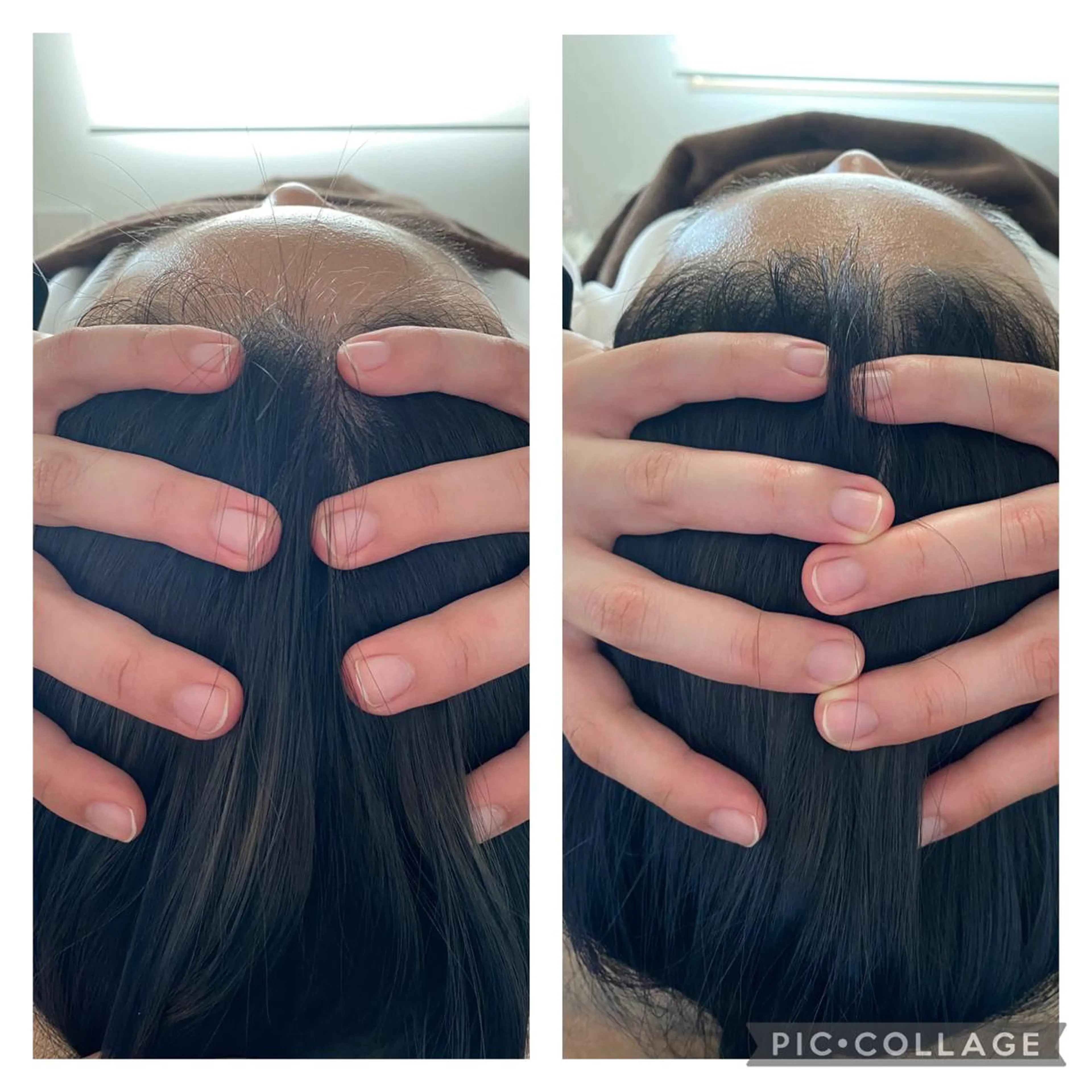 小顔矯正 MEGUMIのエステ・リラクイメージ