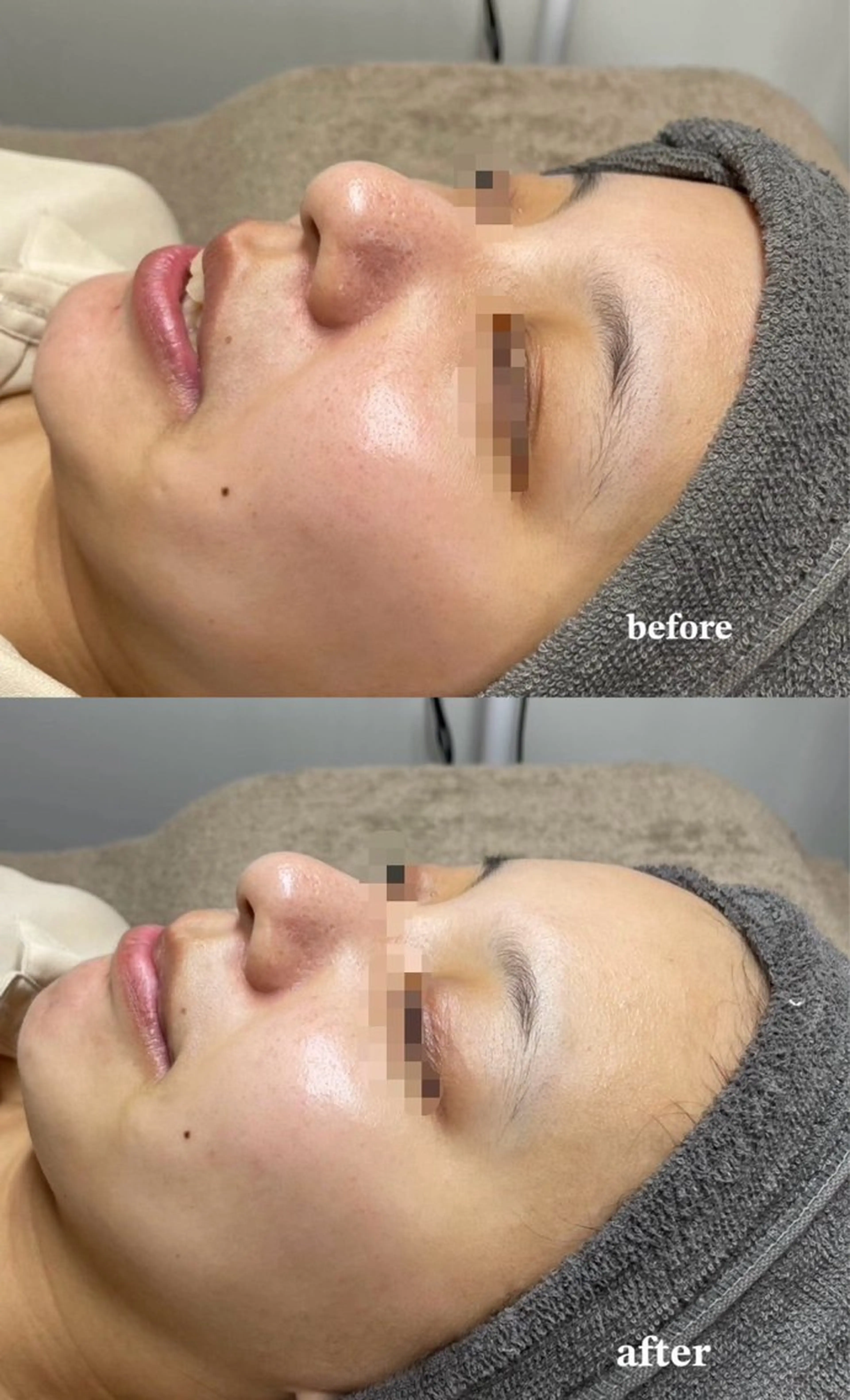 Lily 竹前のネイルデザイン