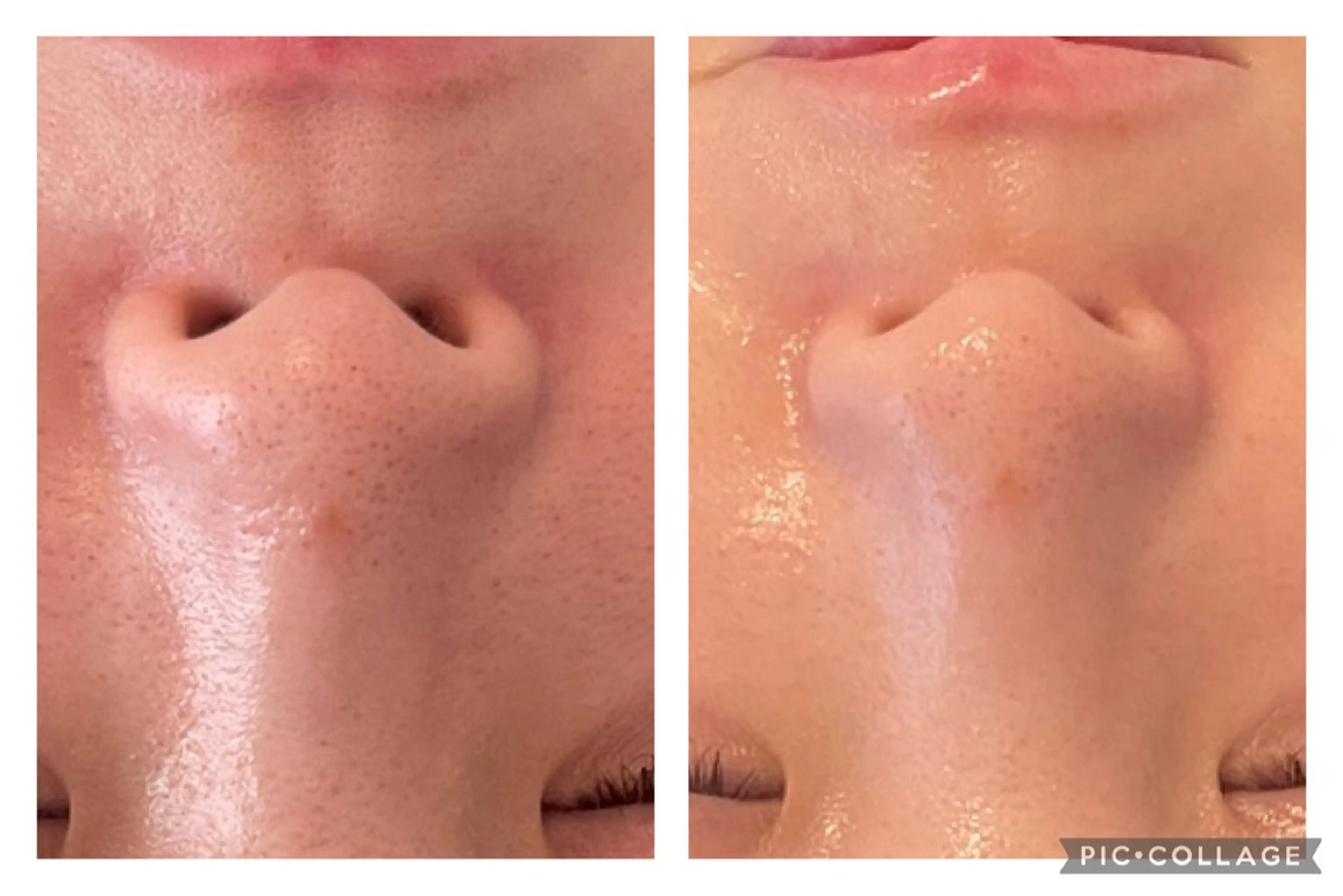 その他 美肌サロン　ナゴミプラス所属・美肌とヘッド　和み+ 福　千賀子のエステ・リラクイメージ