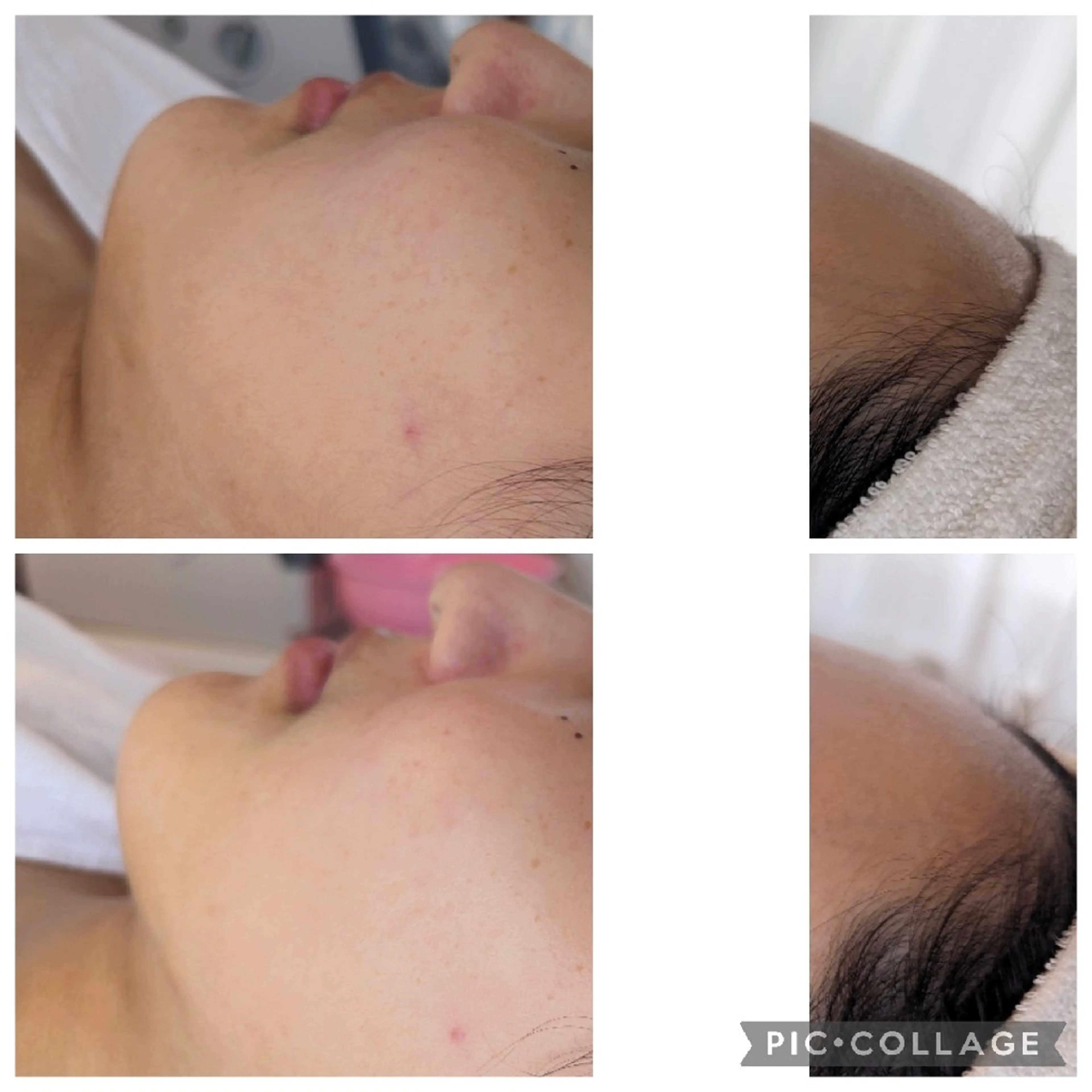 デ・アイム王寺所属・たるみ解消エミリーノ 米田真美子のエステ・リラクイメージ