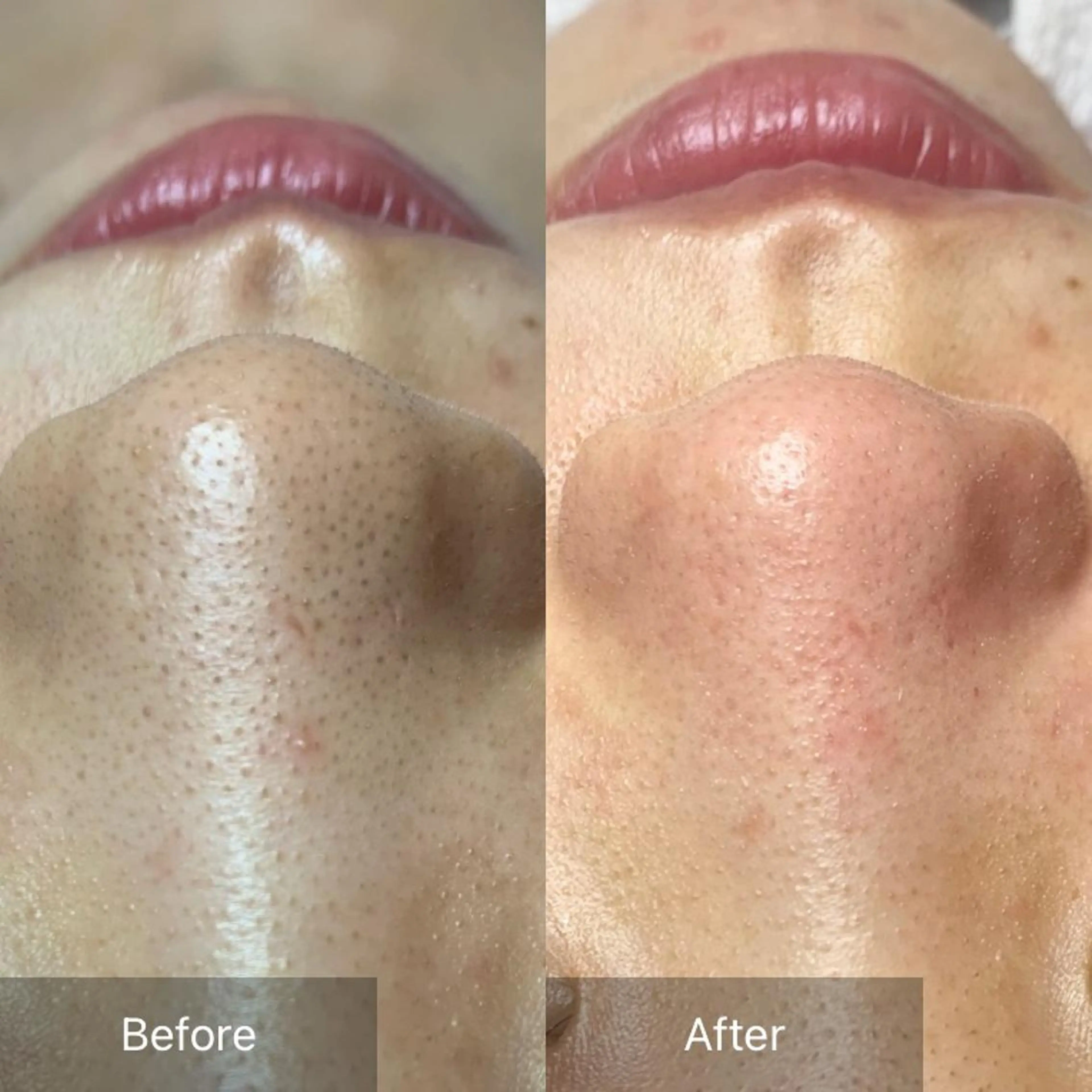 ロング カラー パーマ ヘアアレンジ メンズ キッズ ネイル マツエク・マツパ アイブロウ エステ リラク Lune’as Spa 南青山🫧のエステ・リラクイメージ