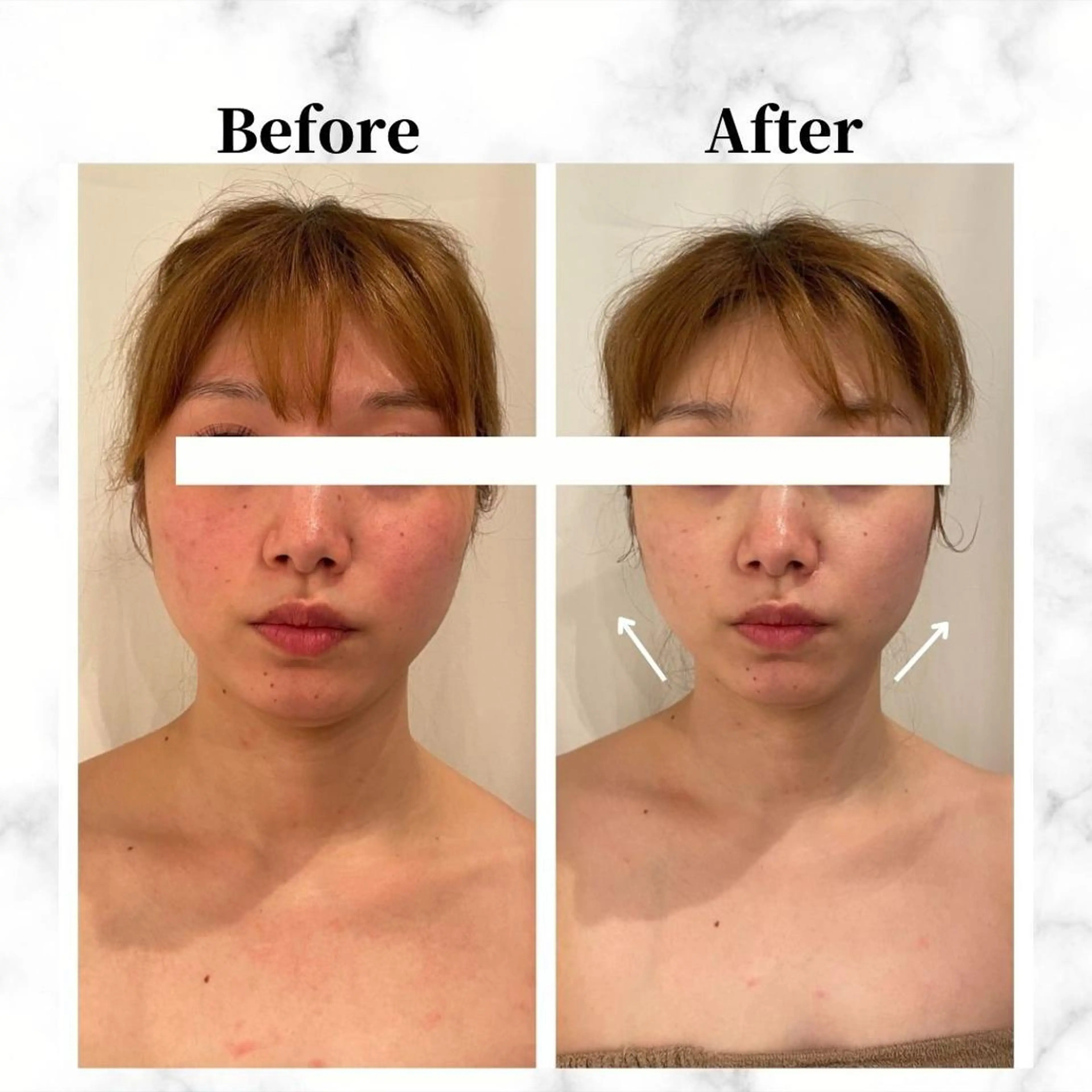 エステ リラク 12Dハイフ💗 最強小顔のエステ・リラクイメージ