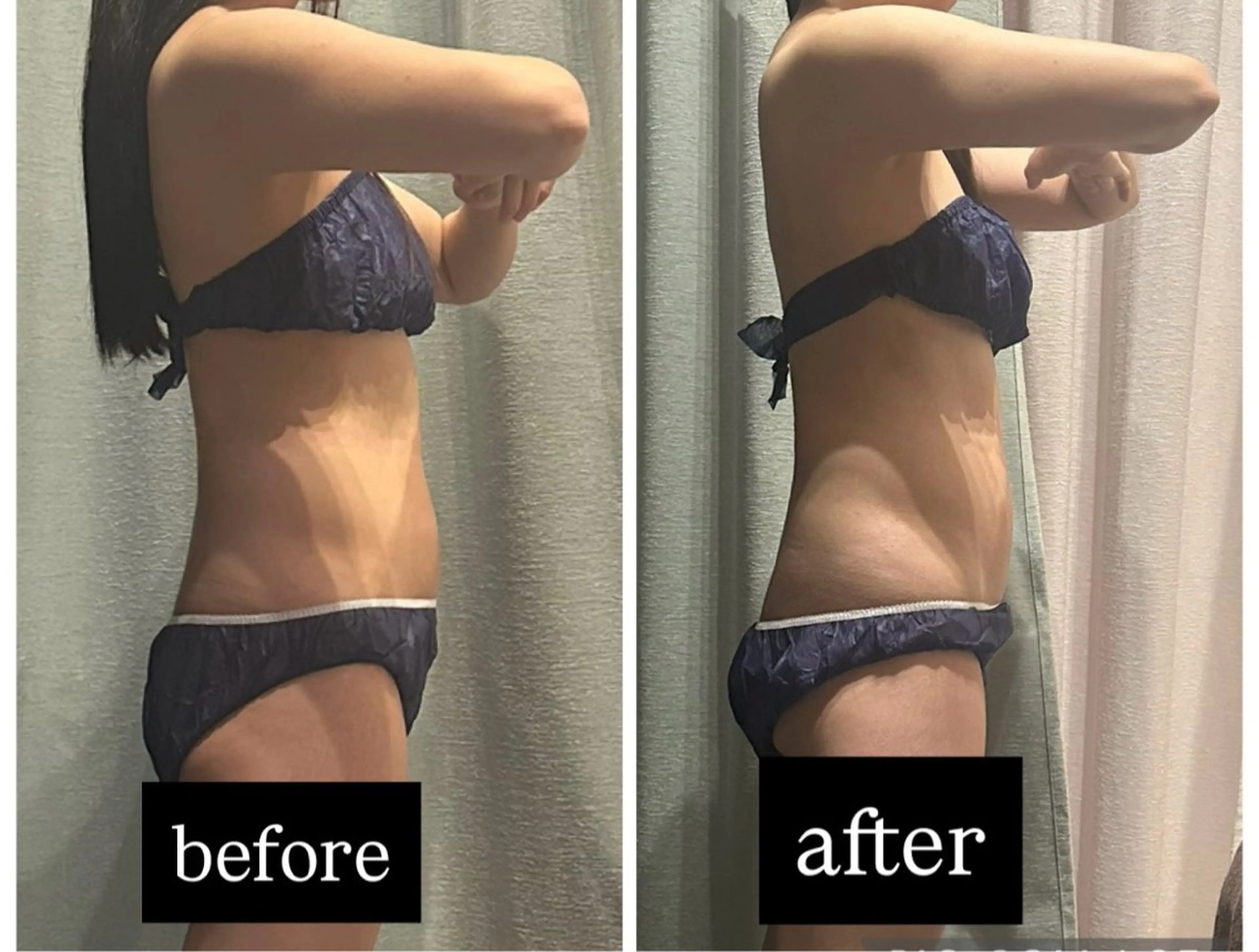 エステ 🌱浮腫|こり|張り 日々の疲れを解消⭐️のエステ・リラクイメージ