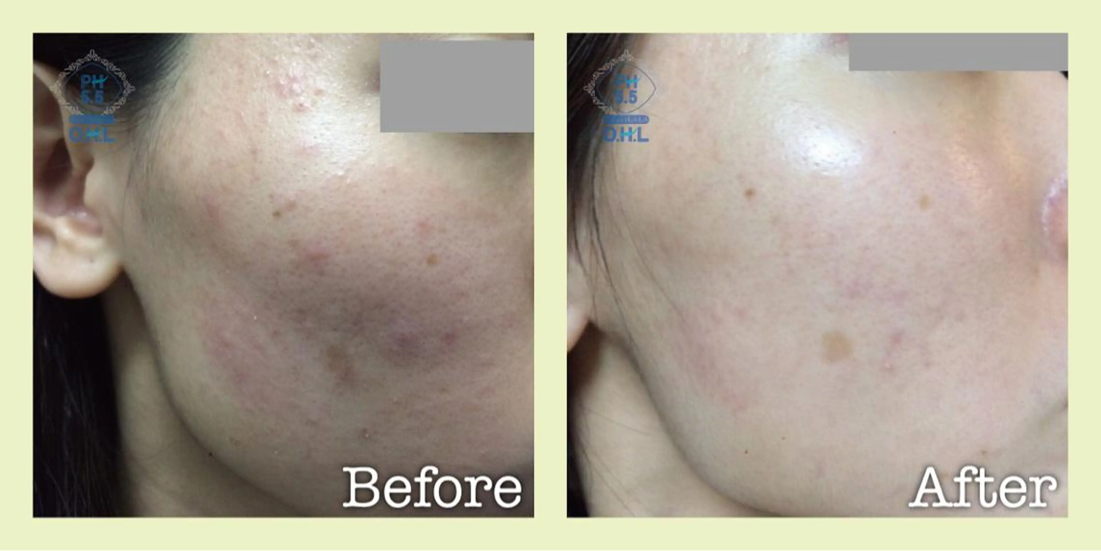 美肌脱毛フェイシャル サロンAMOのエステ・リラクイメージ