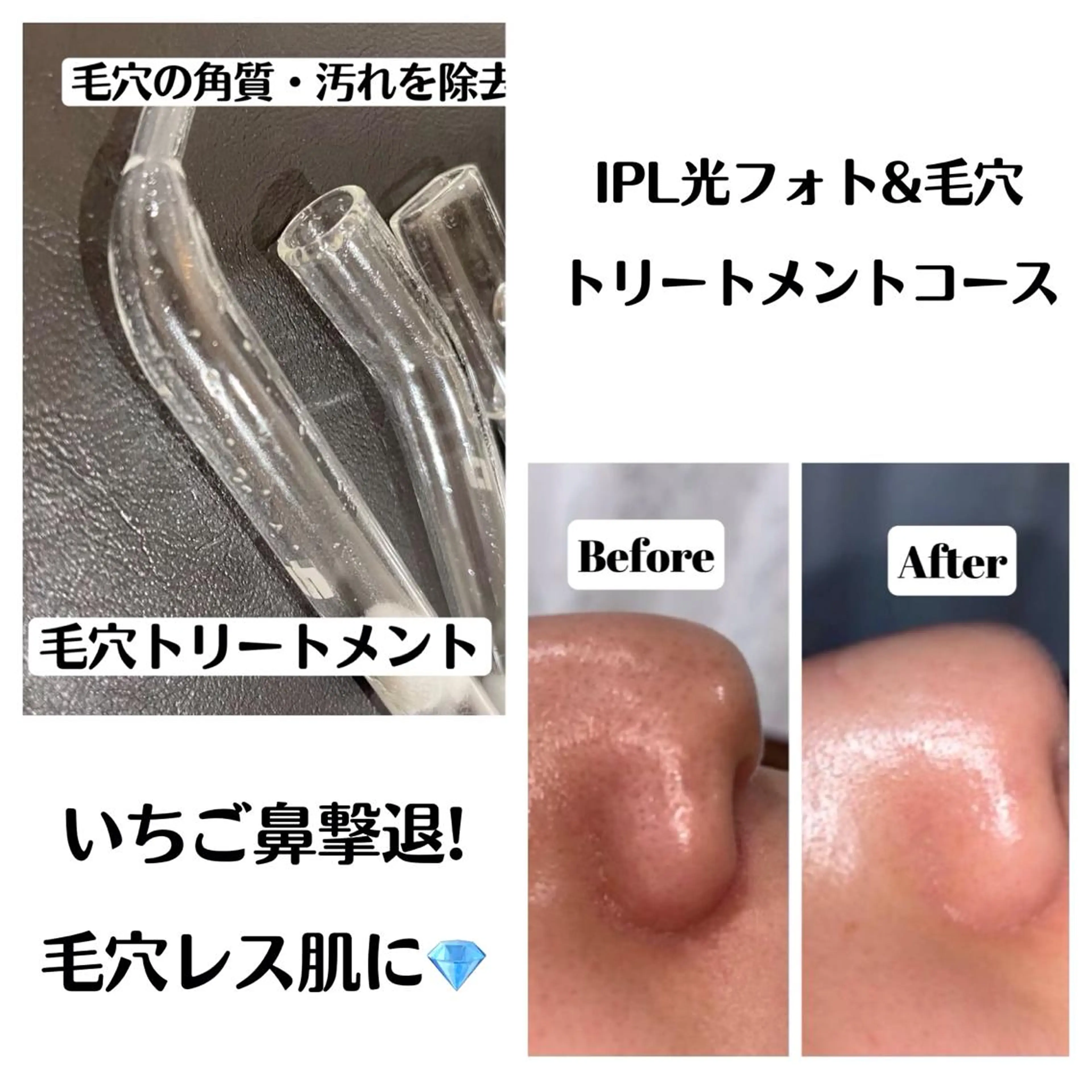 セミロング カラー パーマ ヘアアレンジ メンズ キッズ ネイル マツエク・マツパ アイブロウ 学生(メンズ向け) 眉毛ワックス脱毛 学生 小顔カット トリートメント Chloe-クロエ- 脱毛/フェイシャルのエステ・リラクイメージ