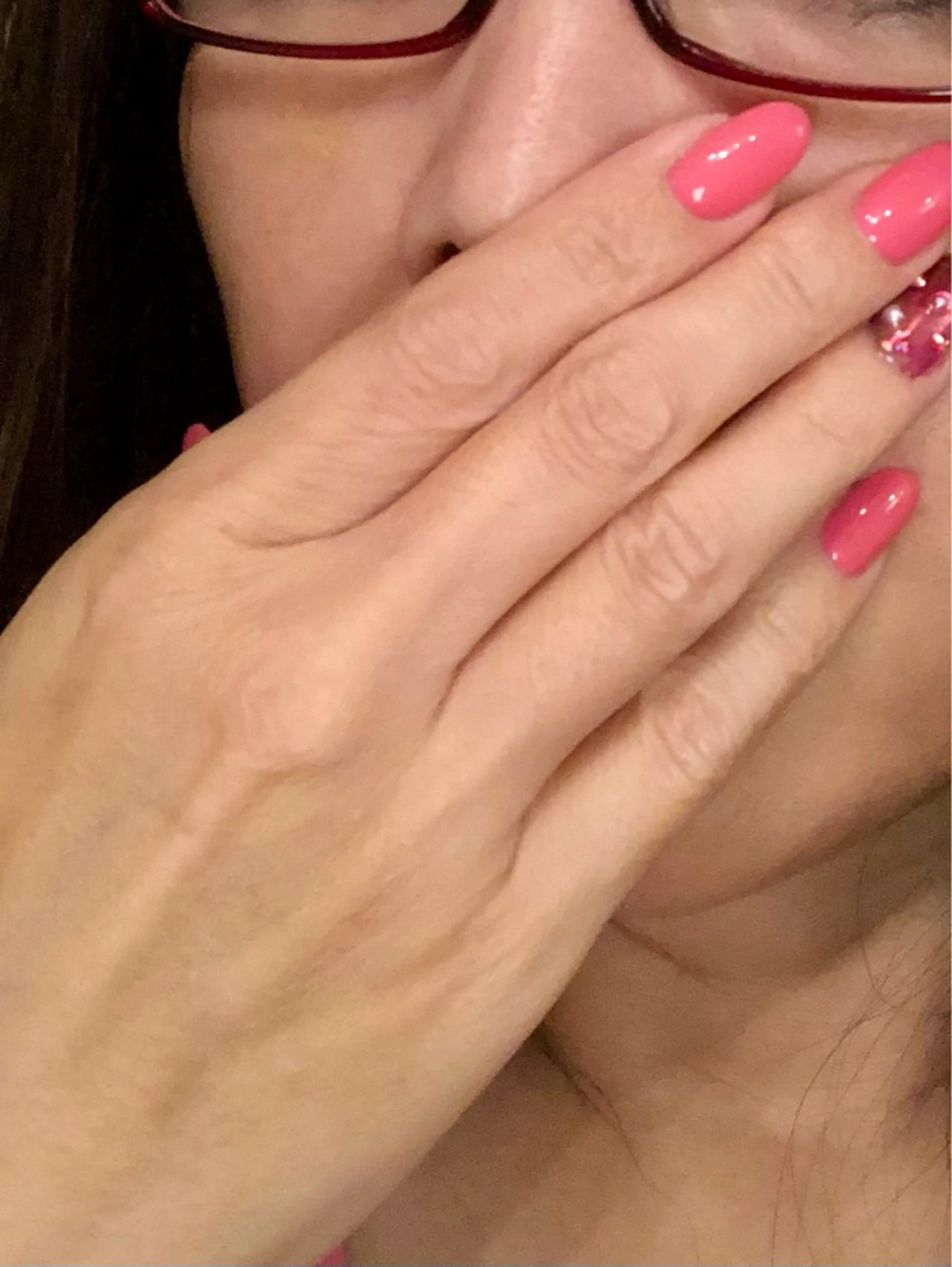 幹細胞美容液を刺さない針で浸透。乾燥・シワ改善し、柔らかな手肌に。男性にも大人気！の写真