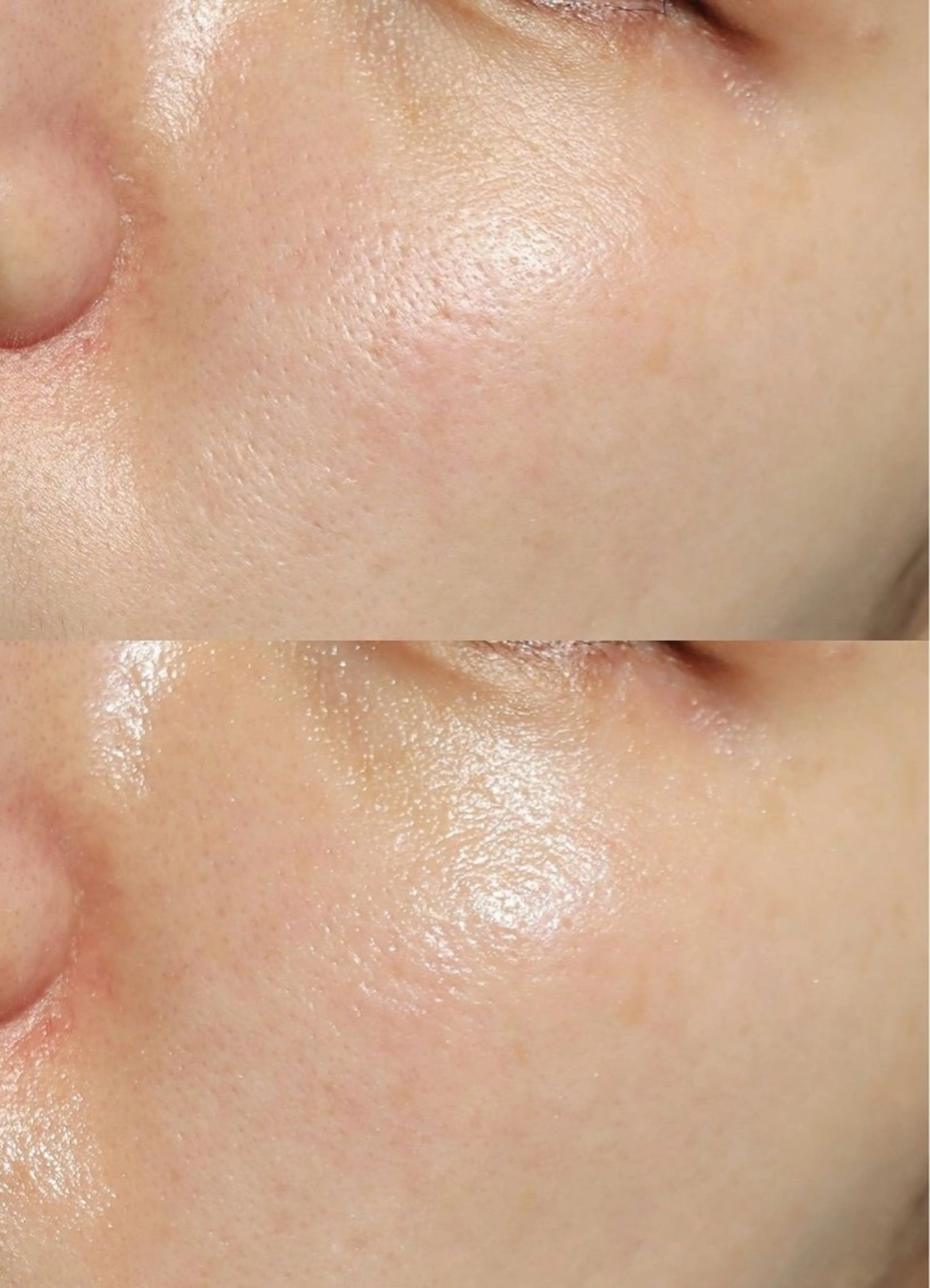 エステ mire（ミレ） トータルビューティーのエステ・リラクイメージ