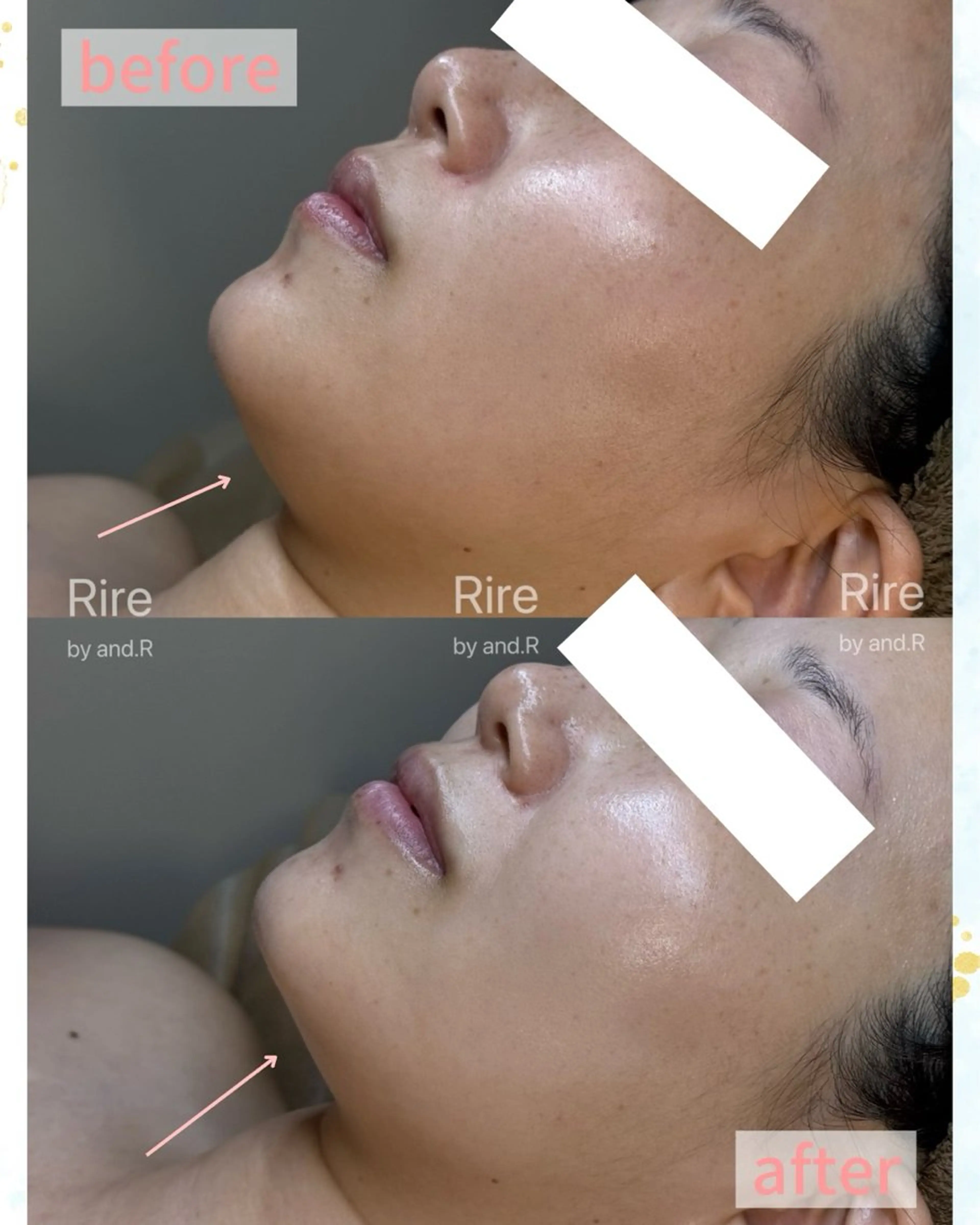 エステ 長野 美里のエステ・リラクイメージ