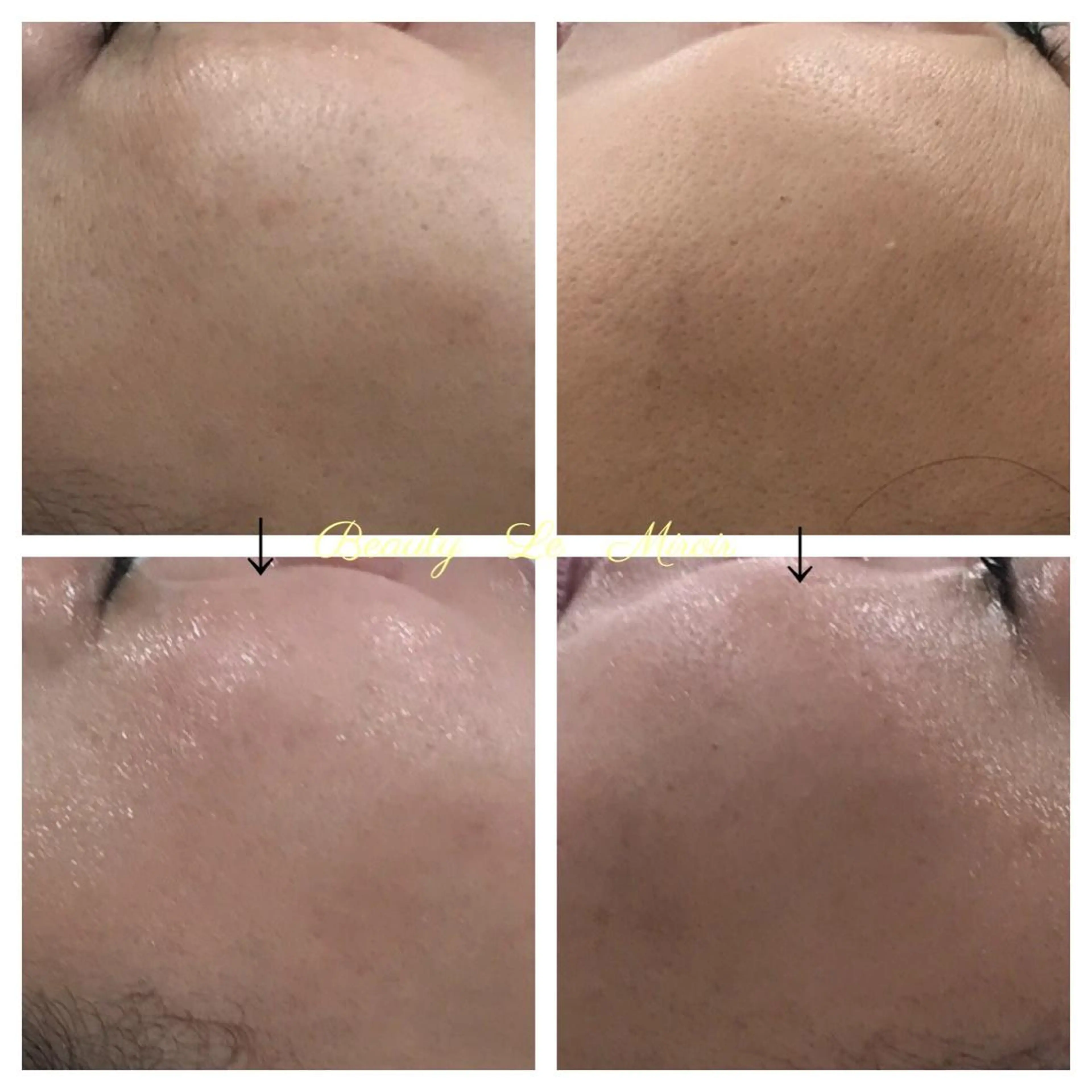 ビューティー ミロワールのエステ・リラクイメージ