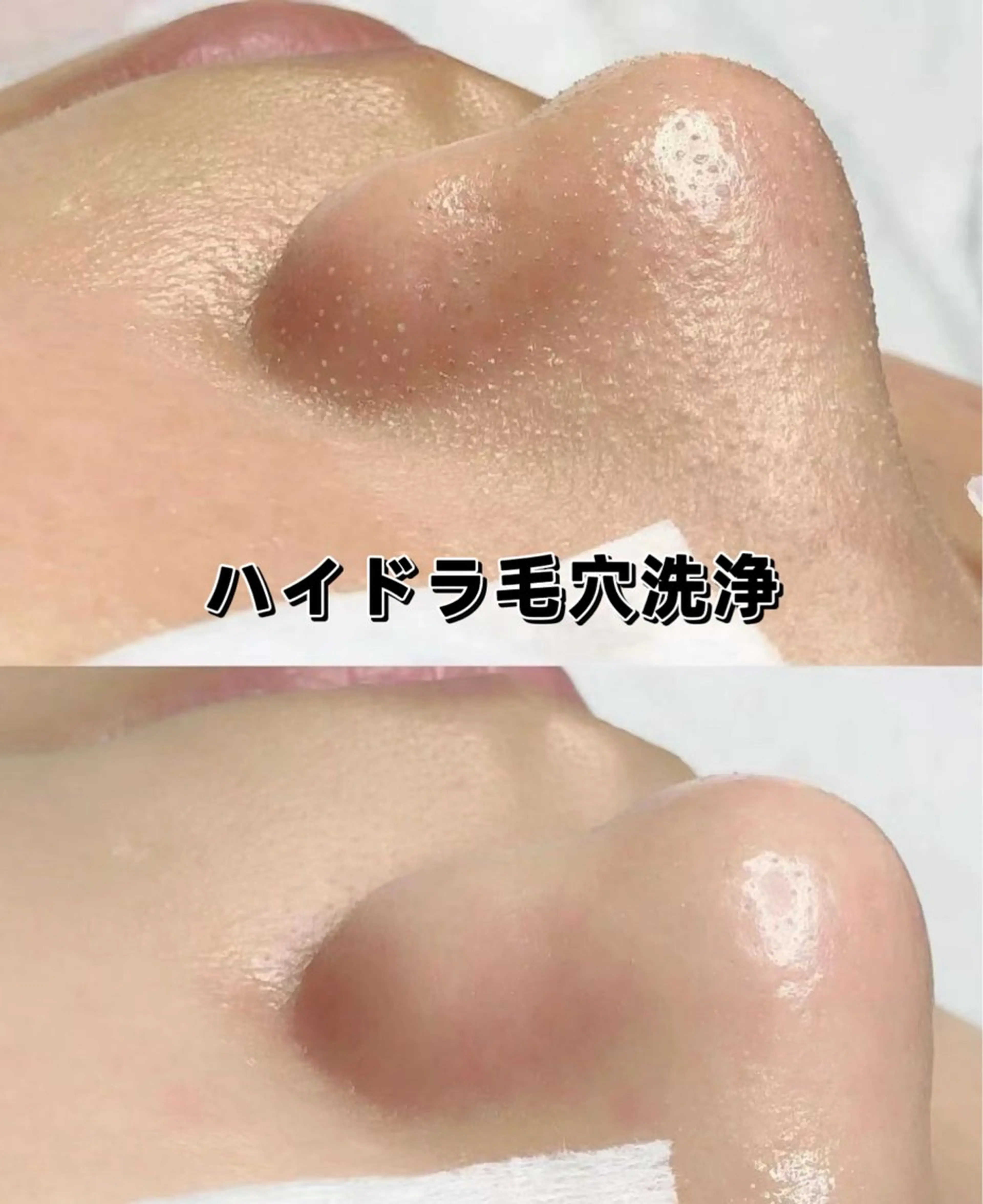 美BELLO 池袋のエステ・リラクイメージ