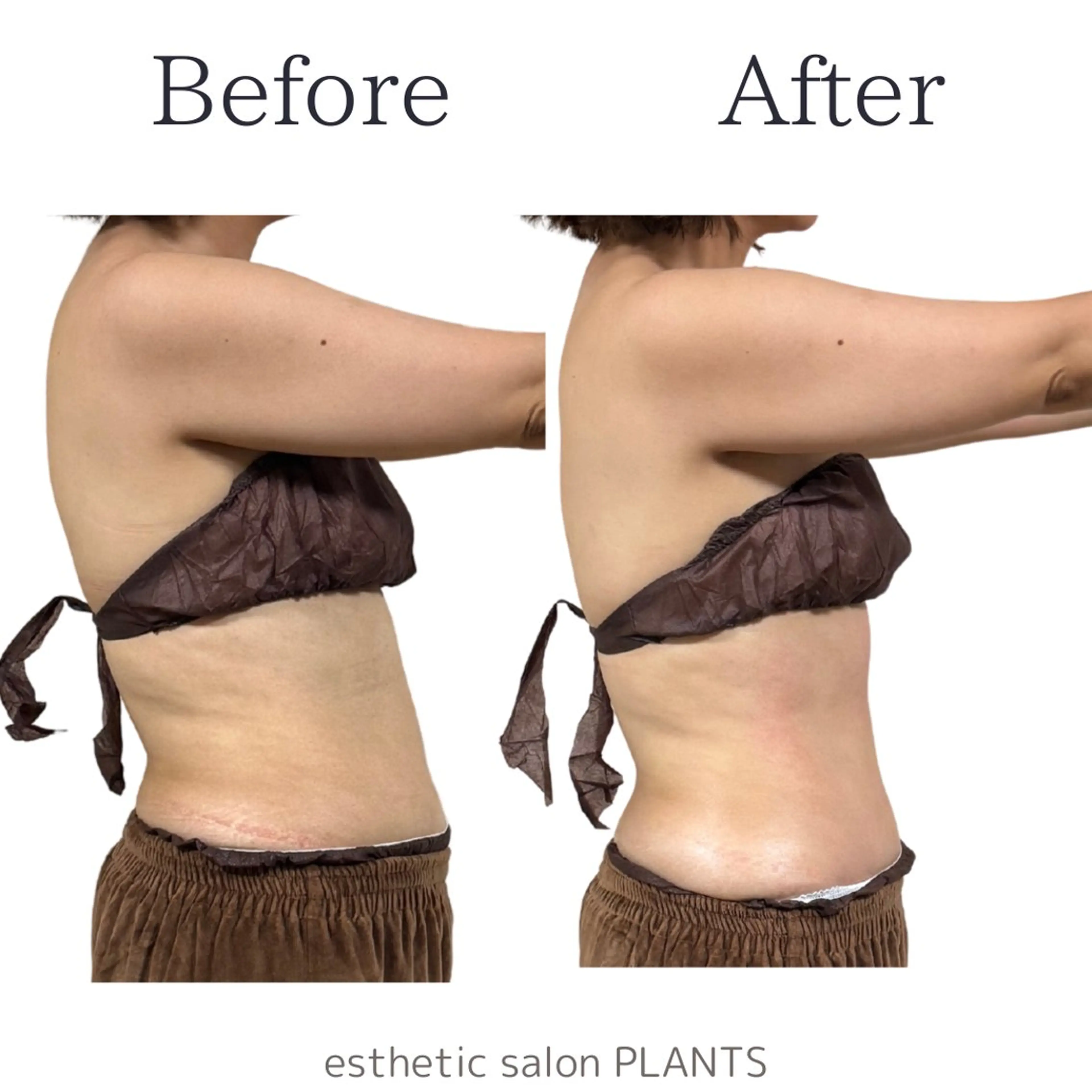 エステ esthetic salon PLANTS所属・エステティックサロン PLANTSのエステ・リラクイメージ