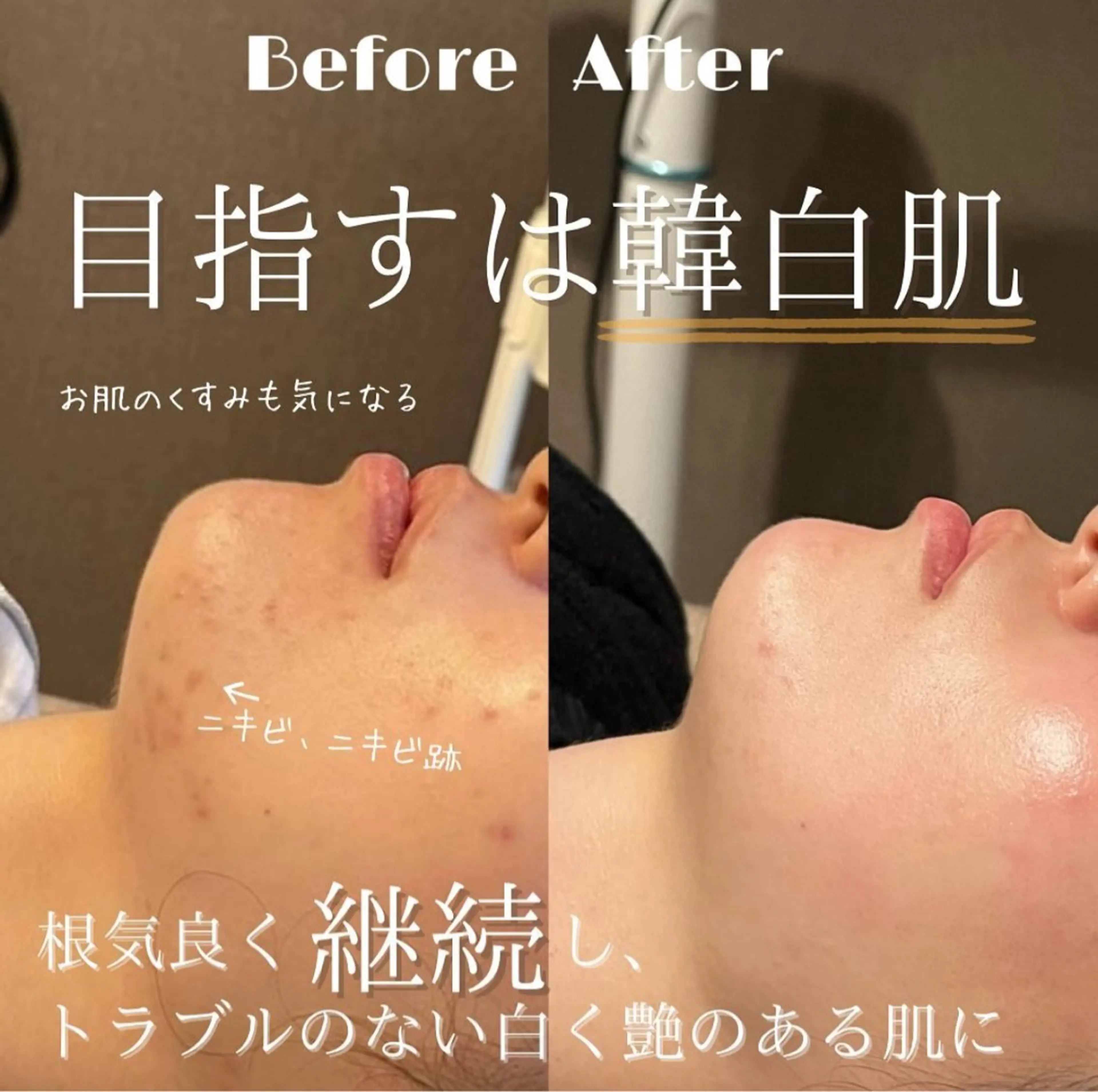 LUMIERE福岡春吉店所属・LUMIERE 福岡のエステ・リラクイメージ