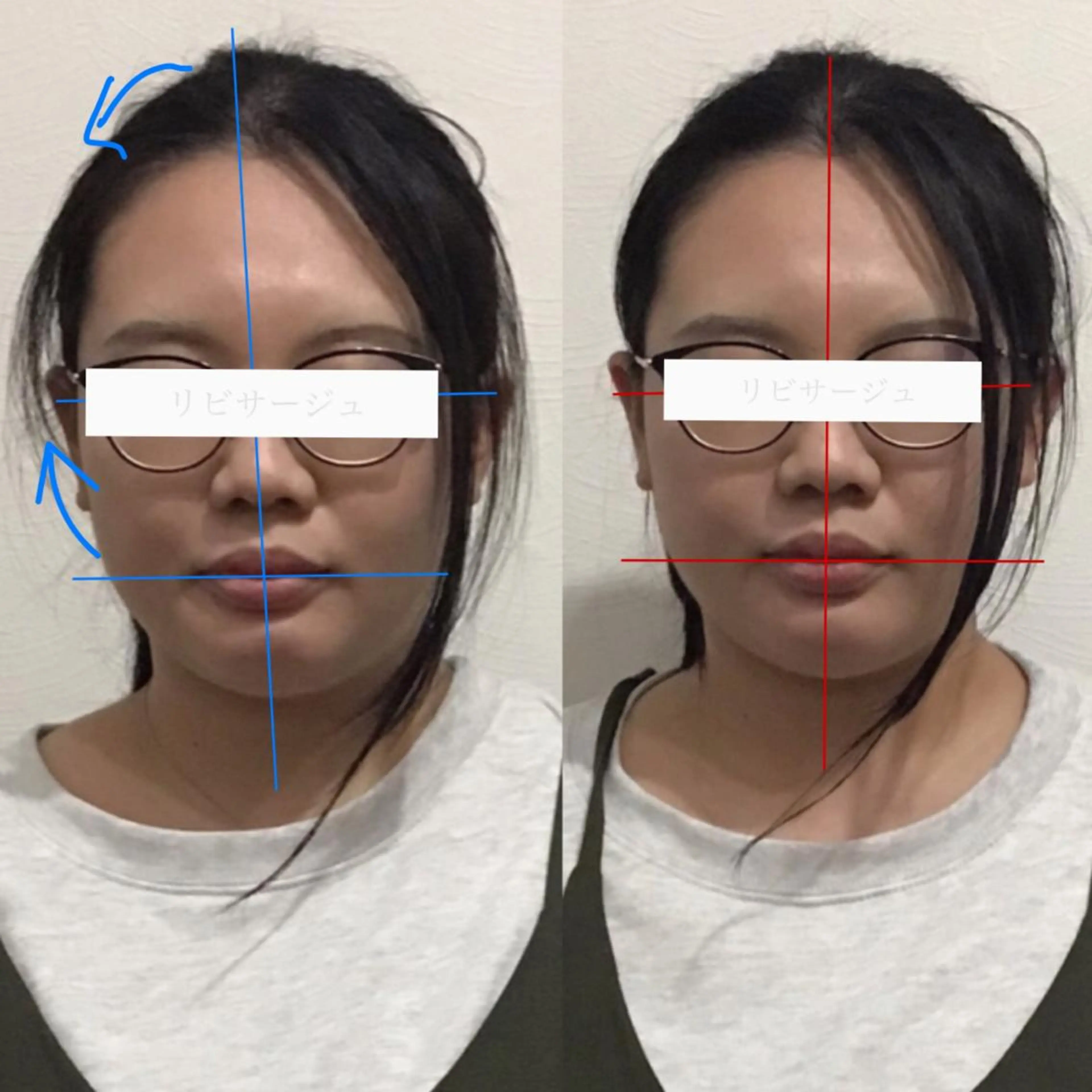 エステ リラク 顔の歪み矯正専門 宮内翔のエステ・リラクイメージ