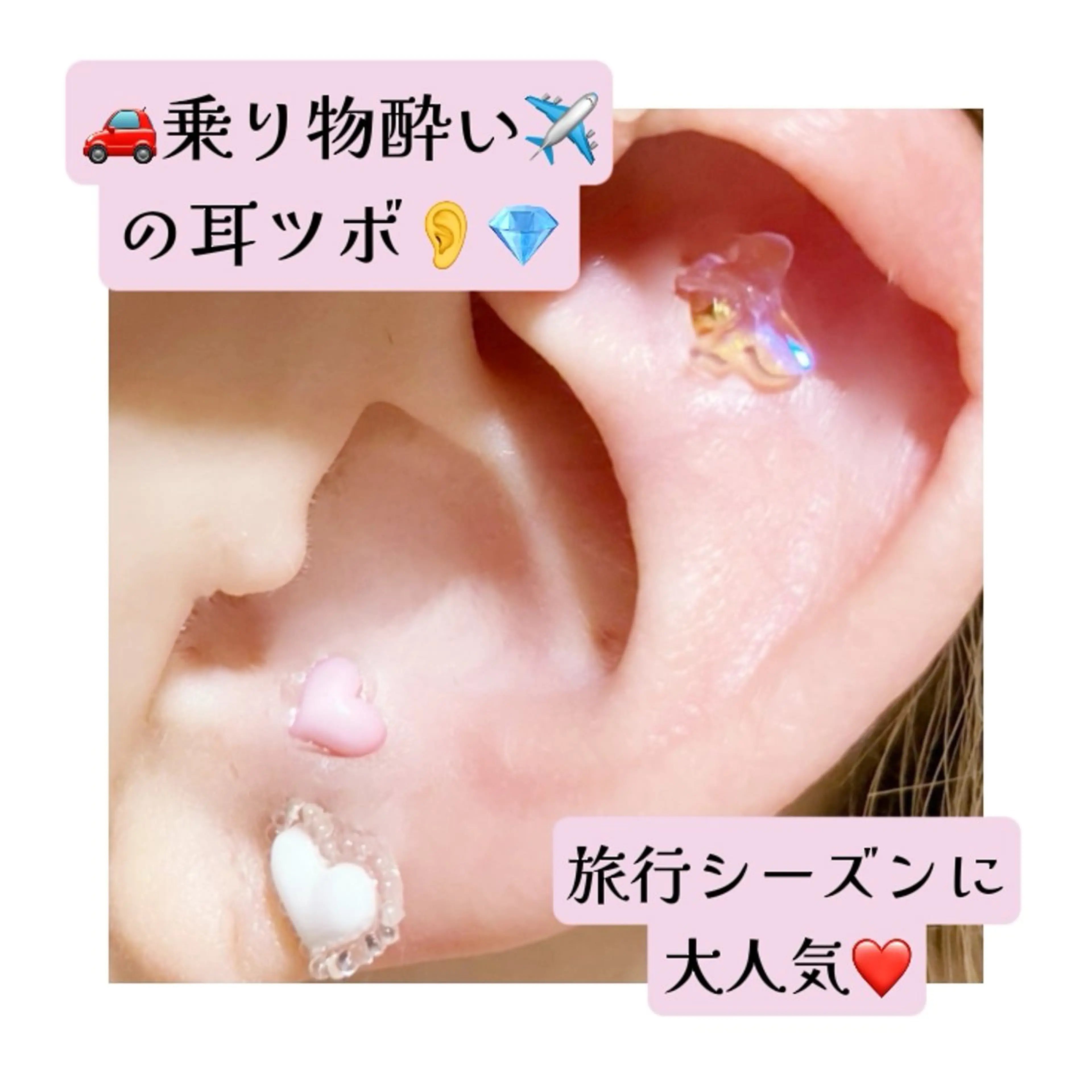 その他 S LOUNGE NAIL(エステ・耳ツボ)所属・耳つぼ💎エステ kimiのその他イメージ