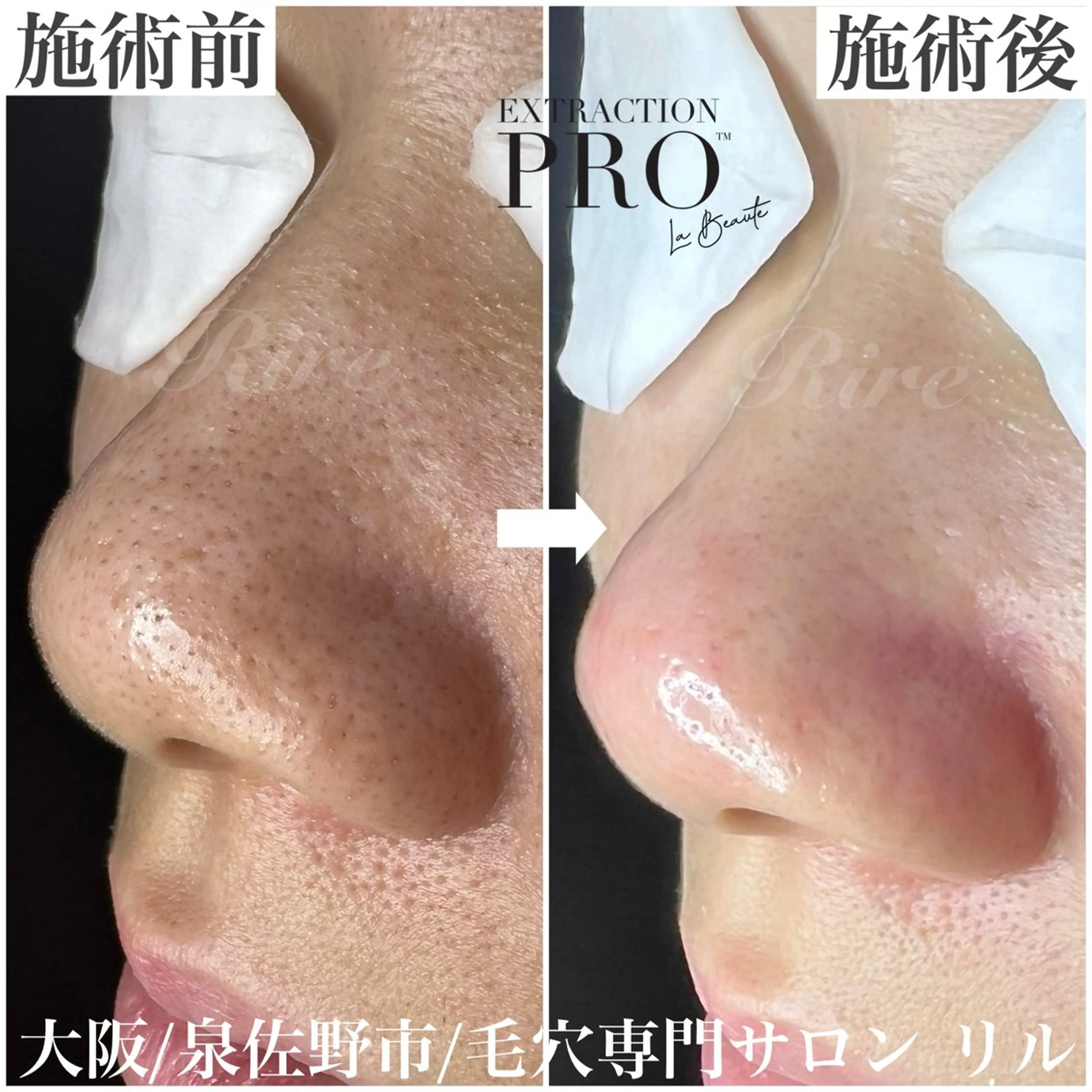 エステ 隅田 都布子のマツエク・マツパデザイン