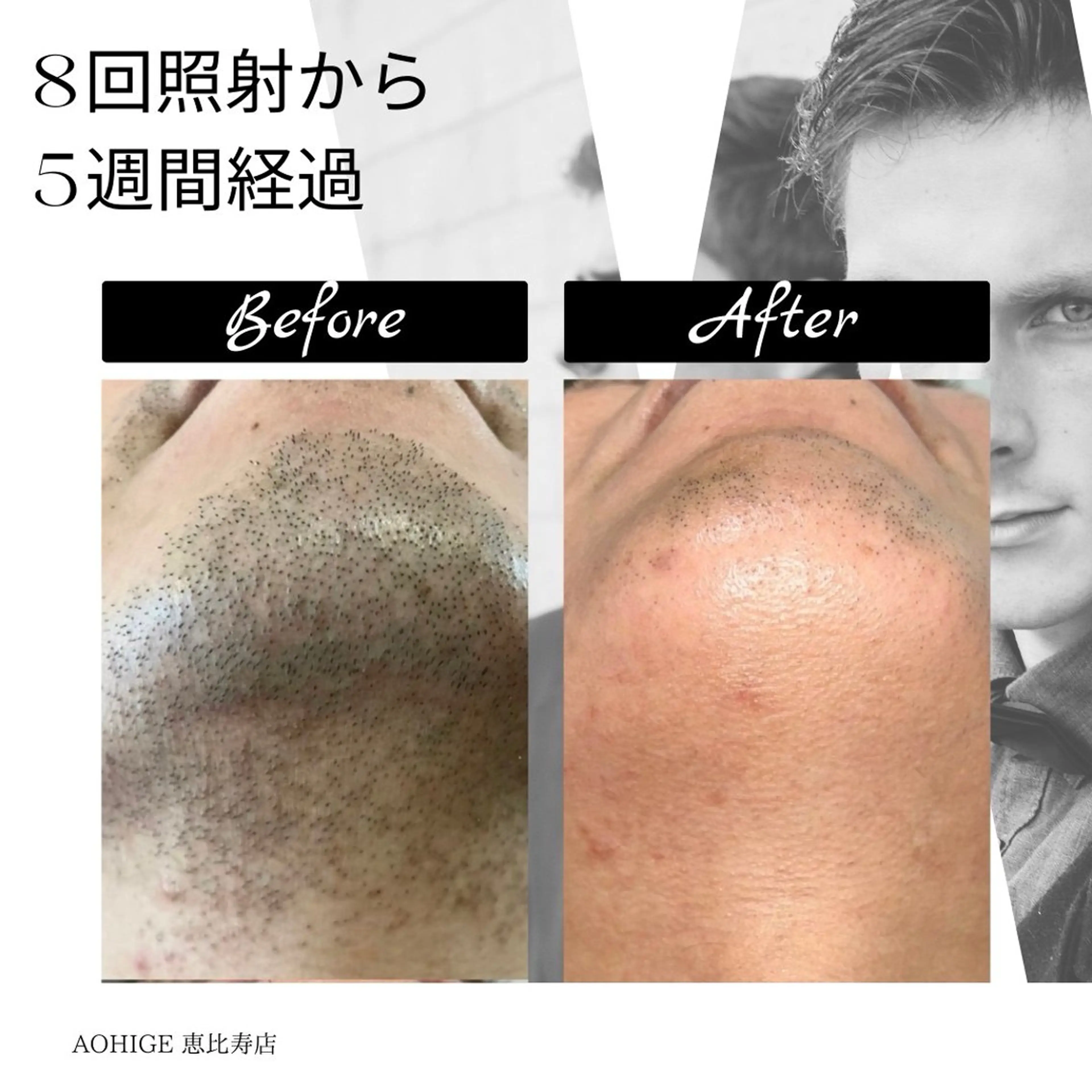 メンズ 【ena】 YUKOのマツエク・マツパデザイン