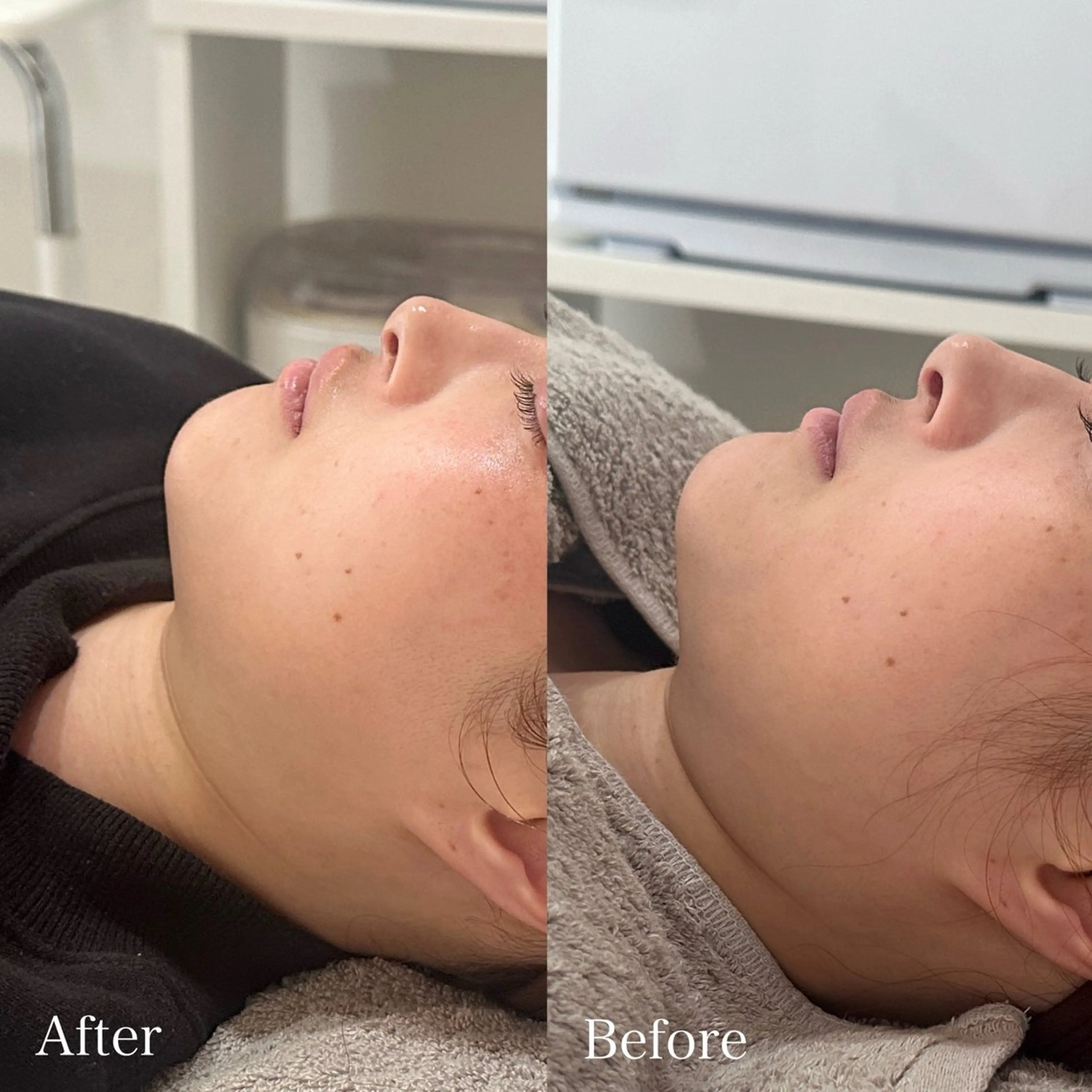 エステ lafleur Yurinaのエステ・リラクイメージ