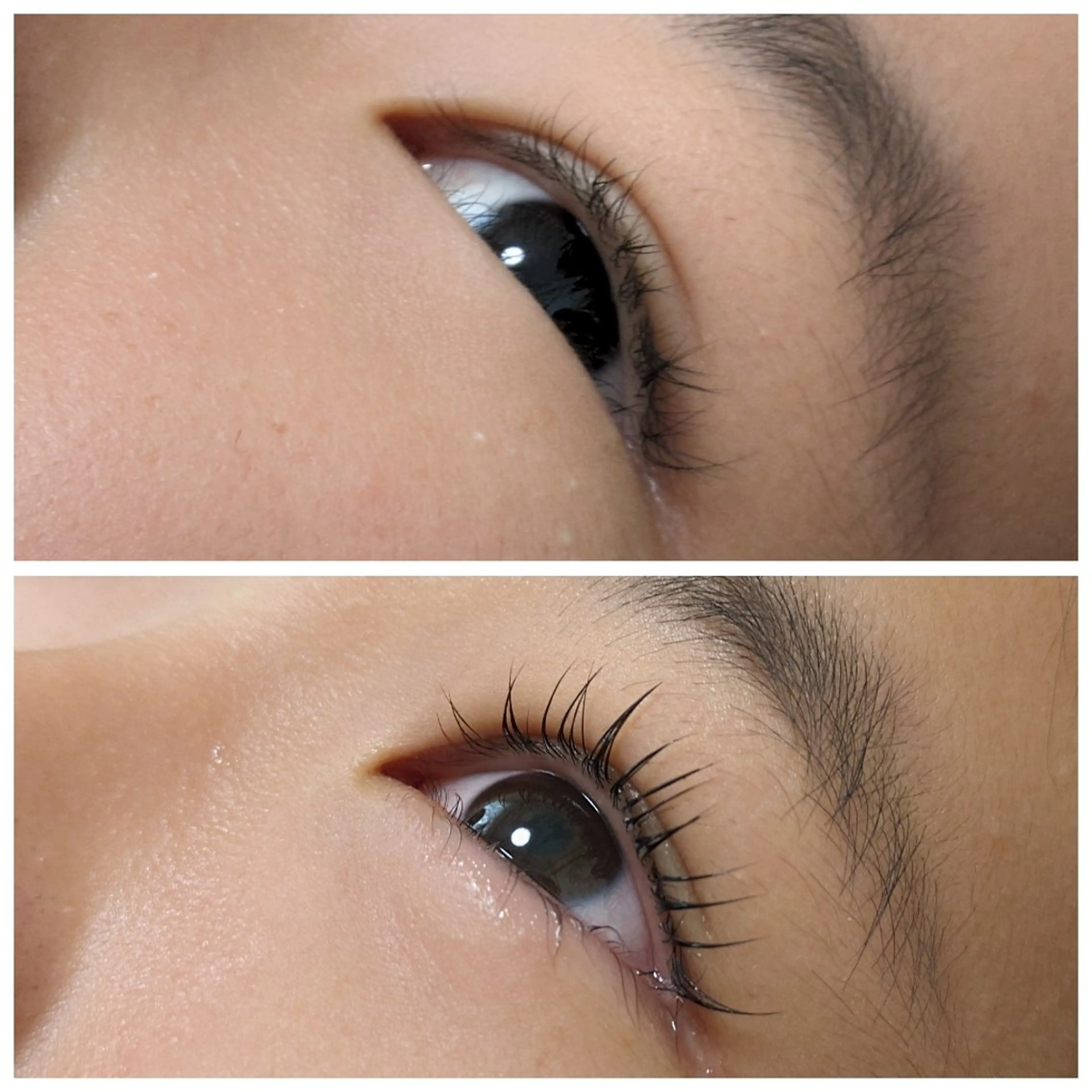 結果が出るスキンケア 肌質改善/まつパのエステ・リラクイメージ