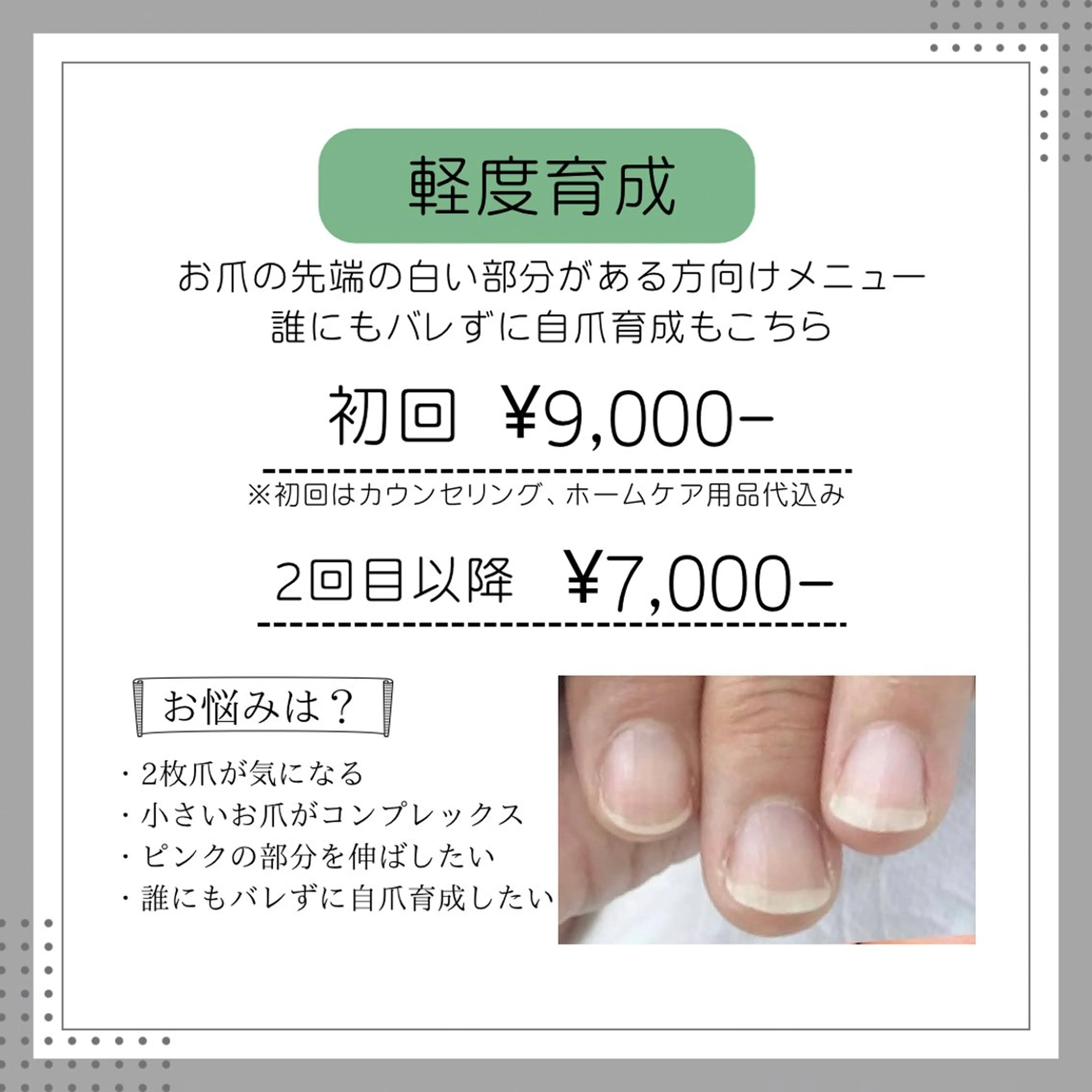 【軽度】自爪育成クリア(艶仕上げor自爪風マット) ※初回ホームケアオイル込みの写真