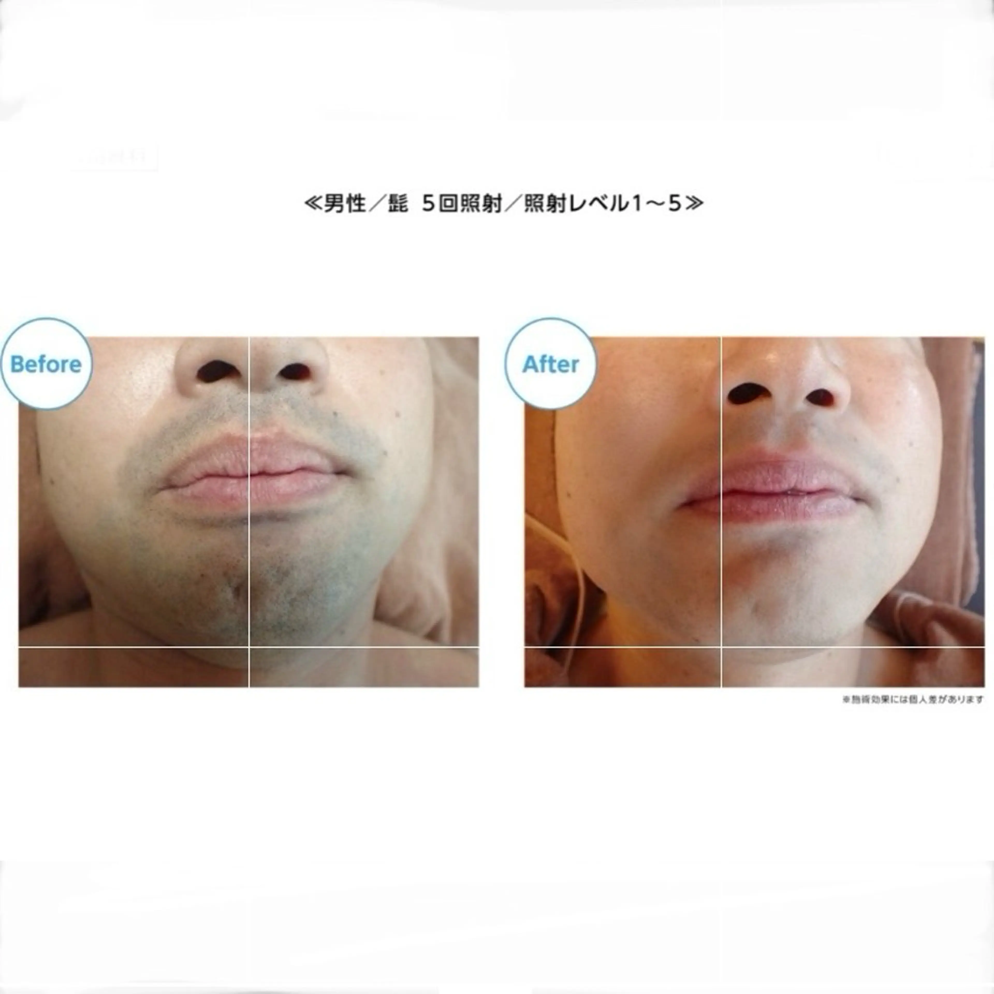 MiEL total beauty salon所属・脱毛サロン MiELのエステ・リラクイメージ