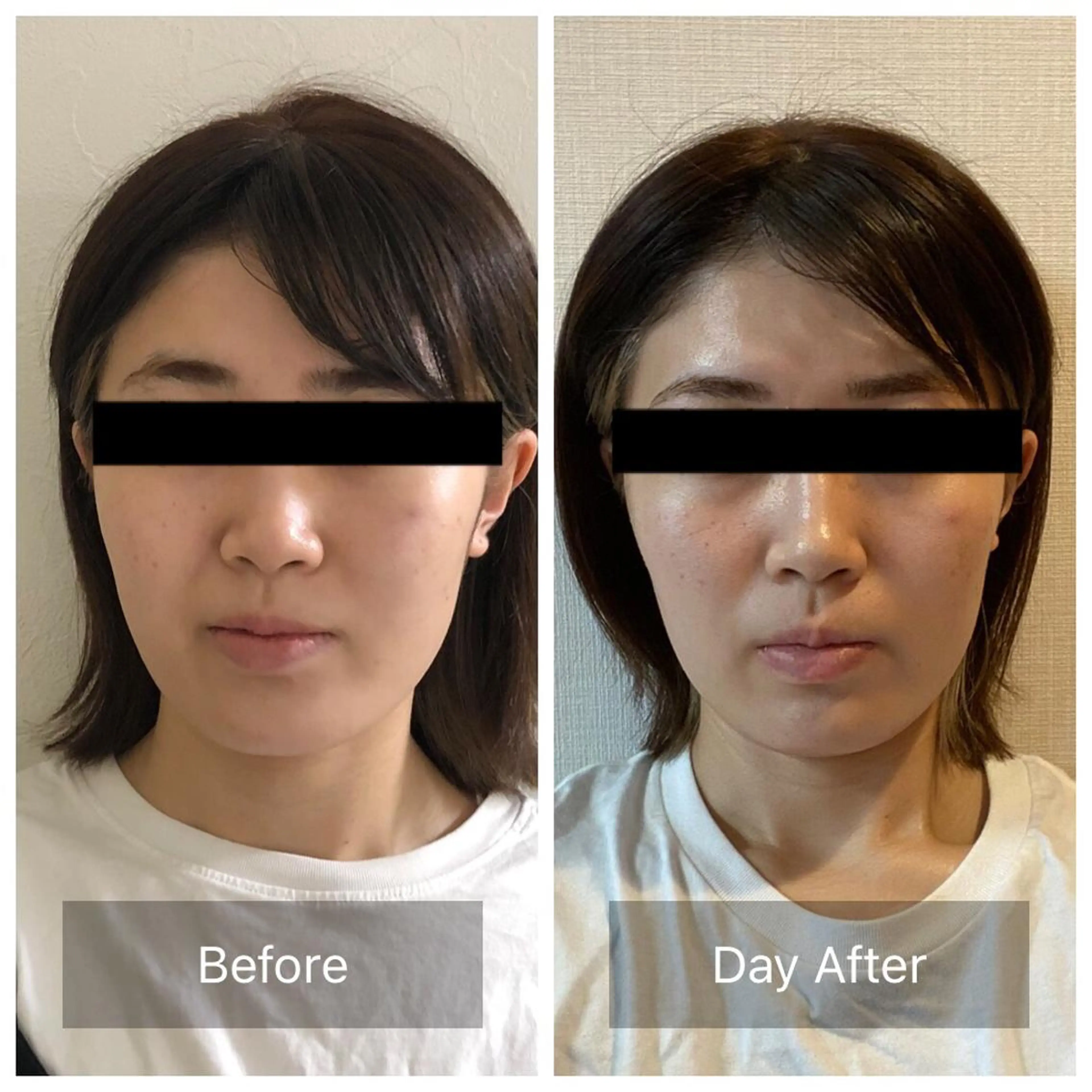 Radiance H.Oのエステ・リラクイメージ