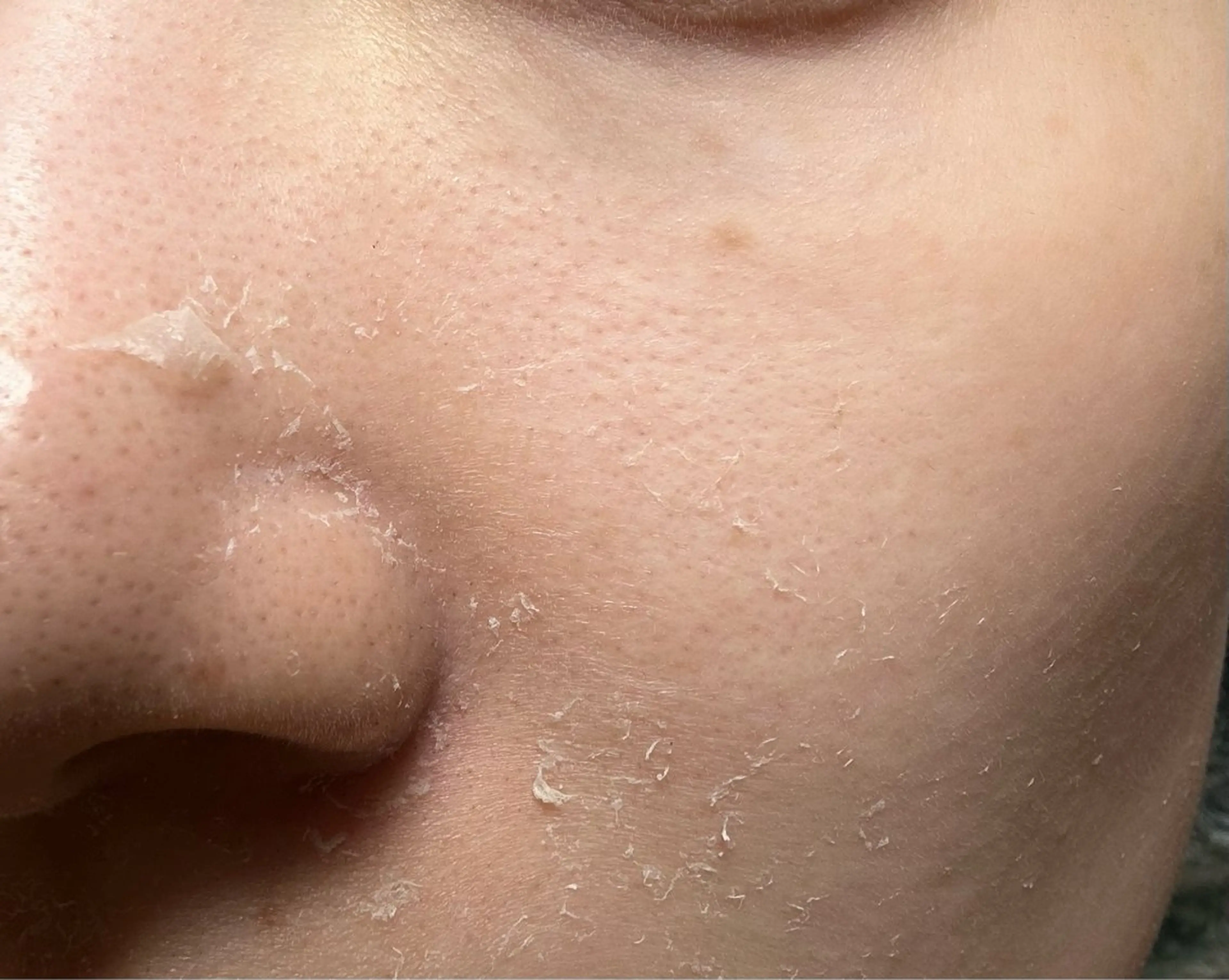 エステ clé skin 🌿ハーブピーリングのエステ・リラクイメージ