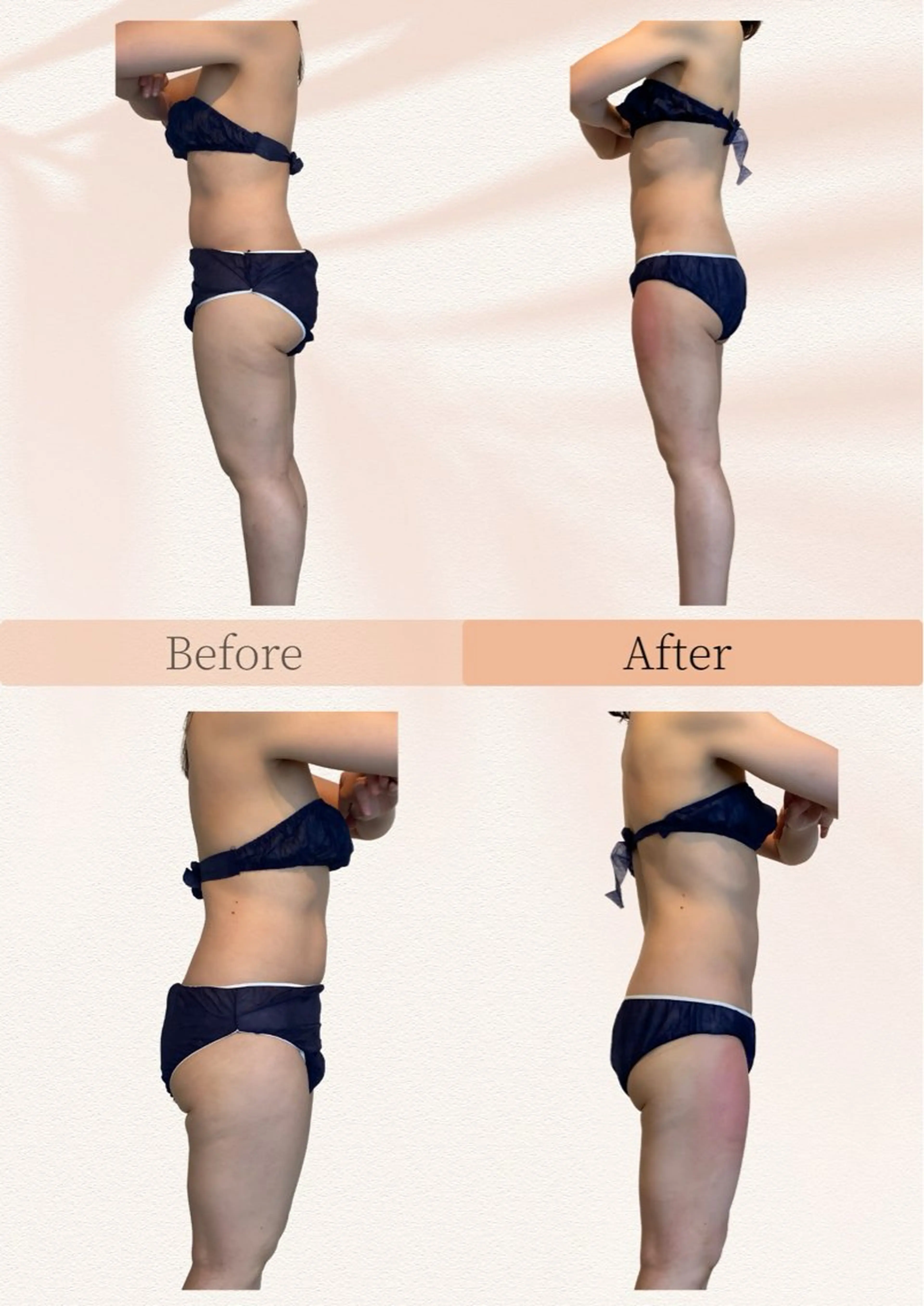 綺麗のひみつ グランプリ受賞店のエステ・リラクイメージ