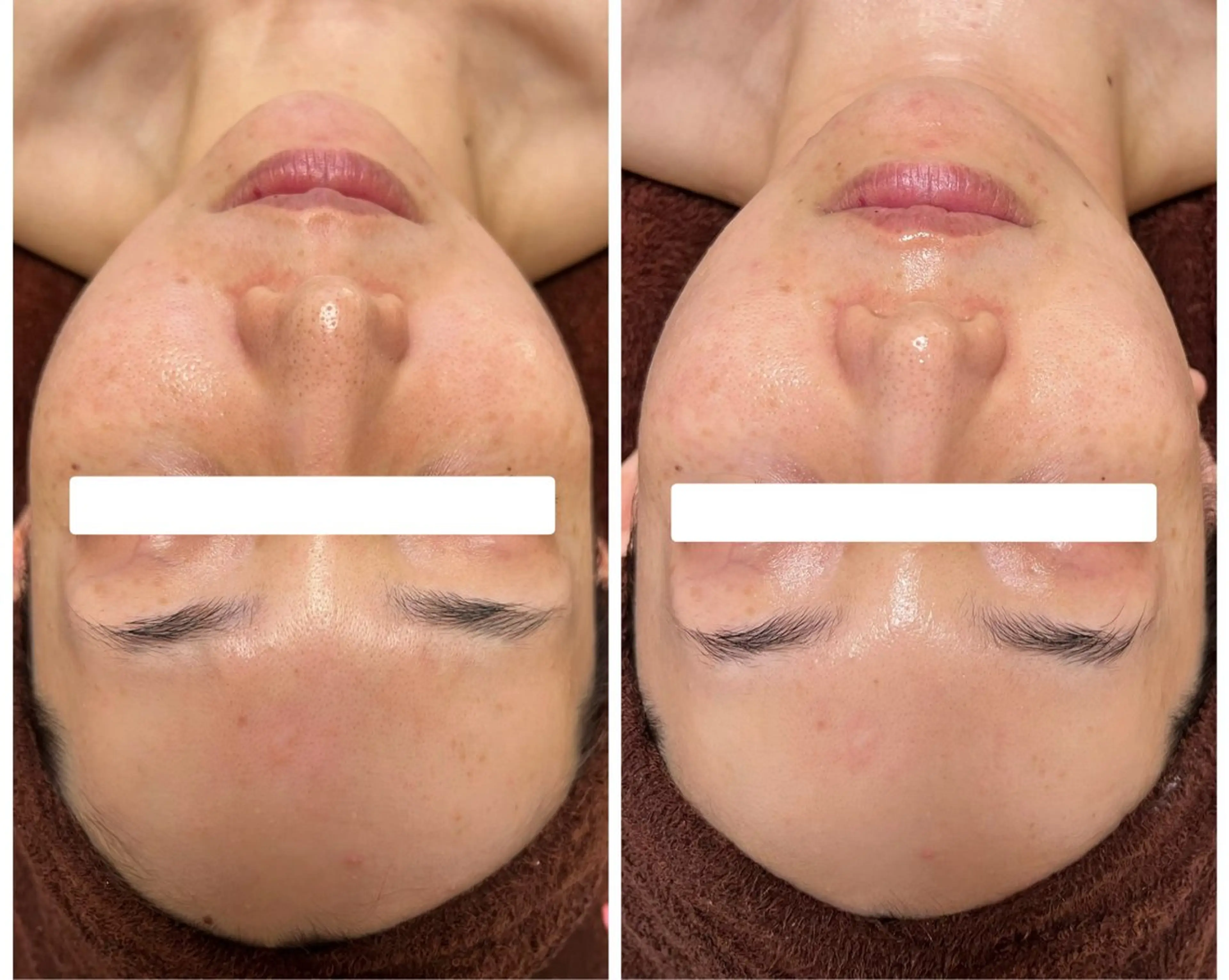 エイジングケア専門 Ponolaのエステ・リラクイメージ