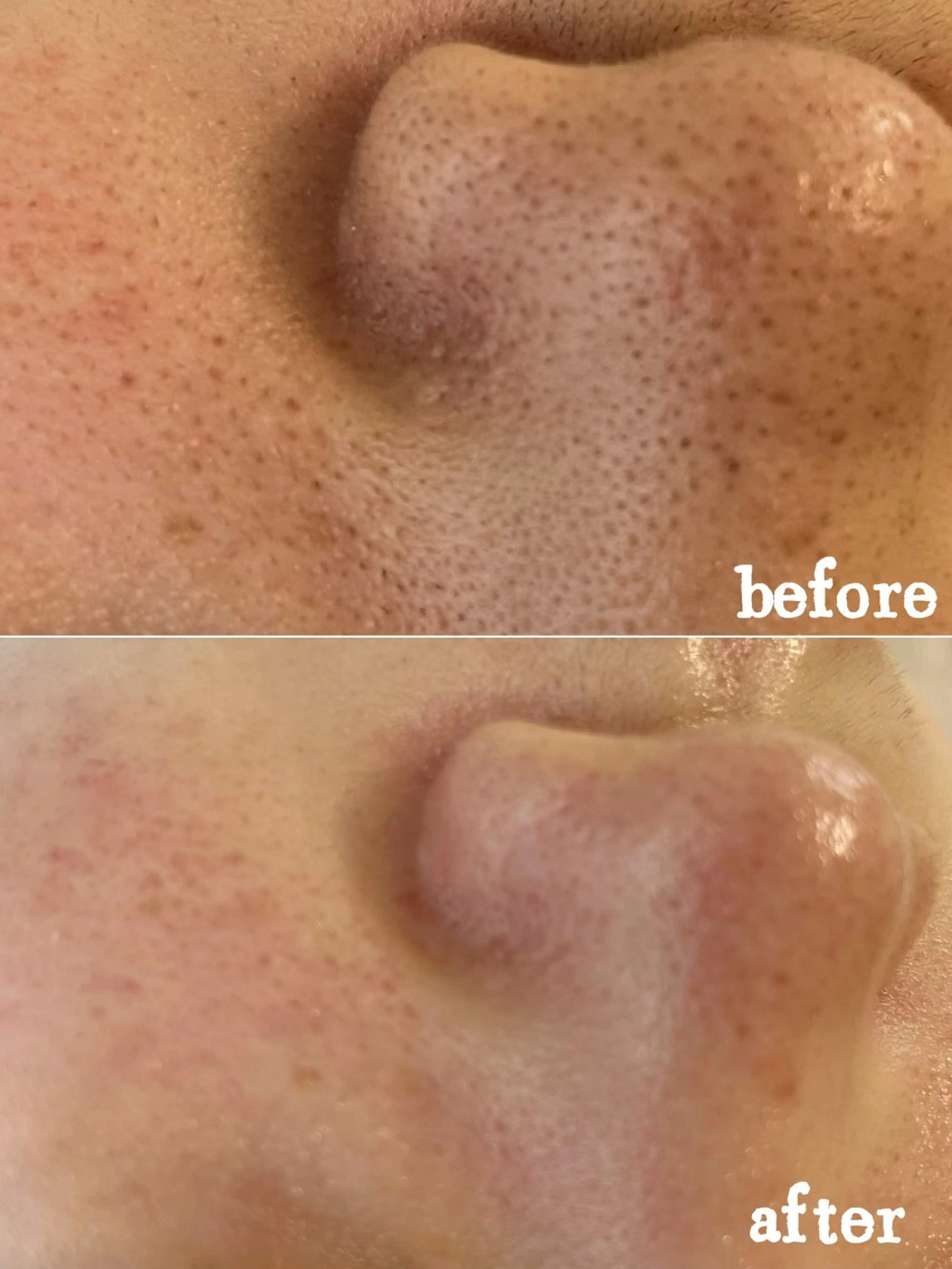 Nature Souce毛穴専門店のその他イメージ