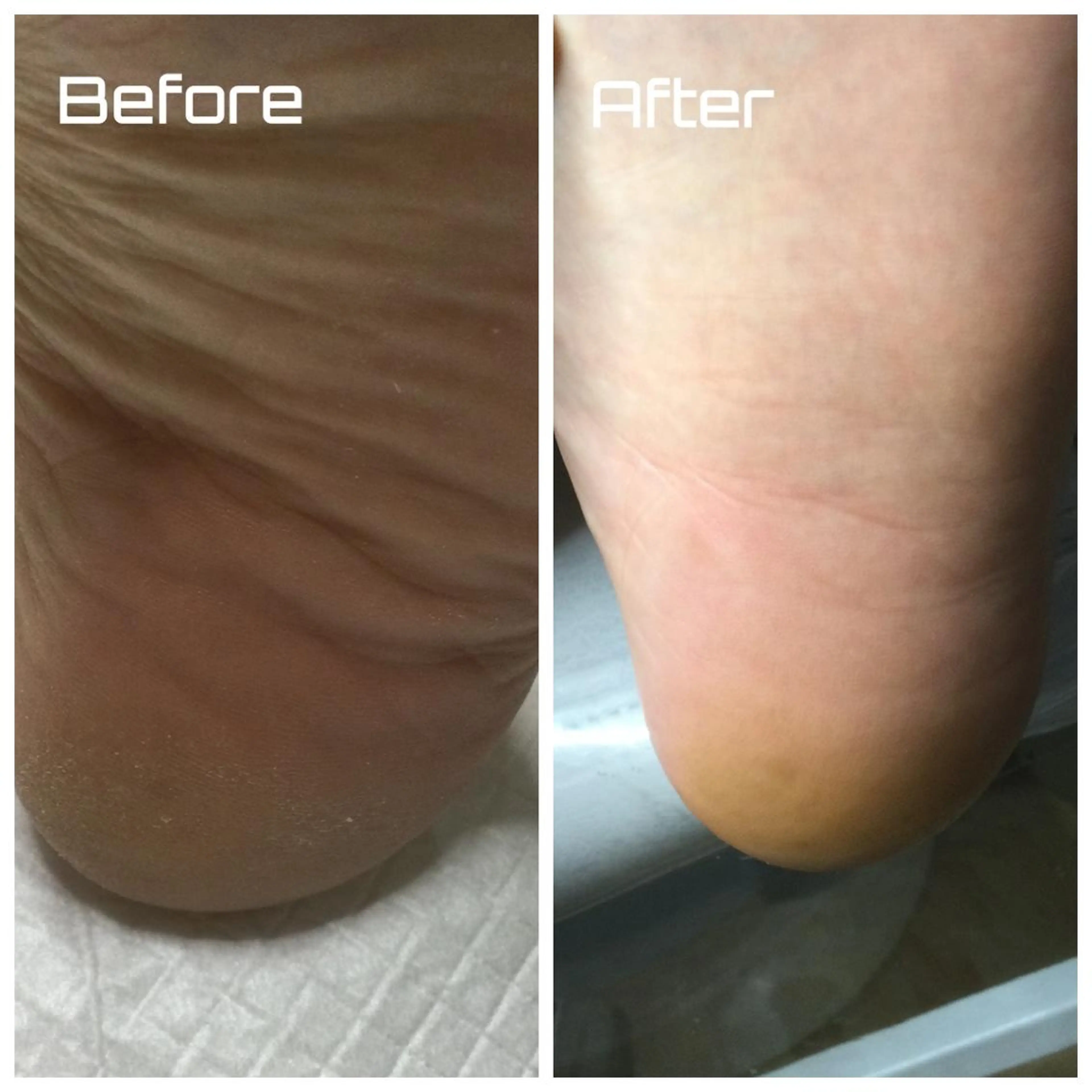 メンズ ネイル ドクターネイル爪革命 takahashiのその他イメージ