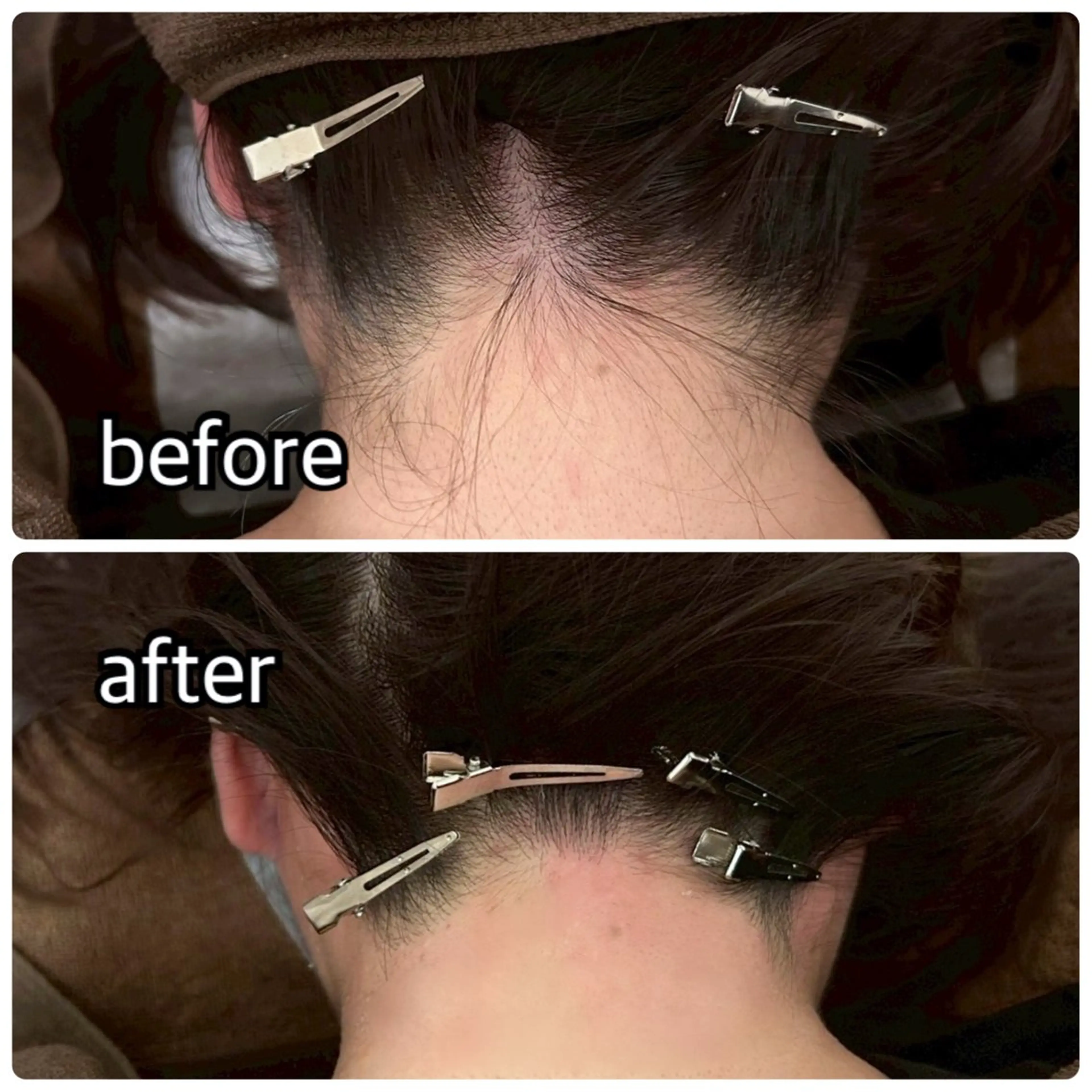 【横浜】アイリス エステティックのエステ・リラクイメージ