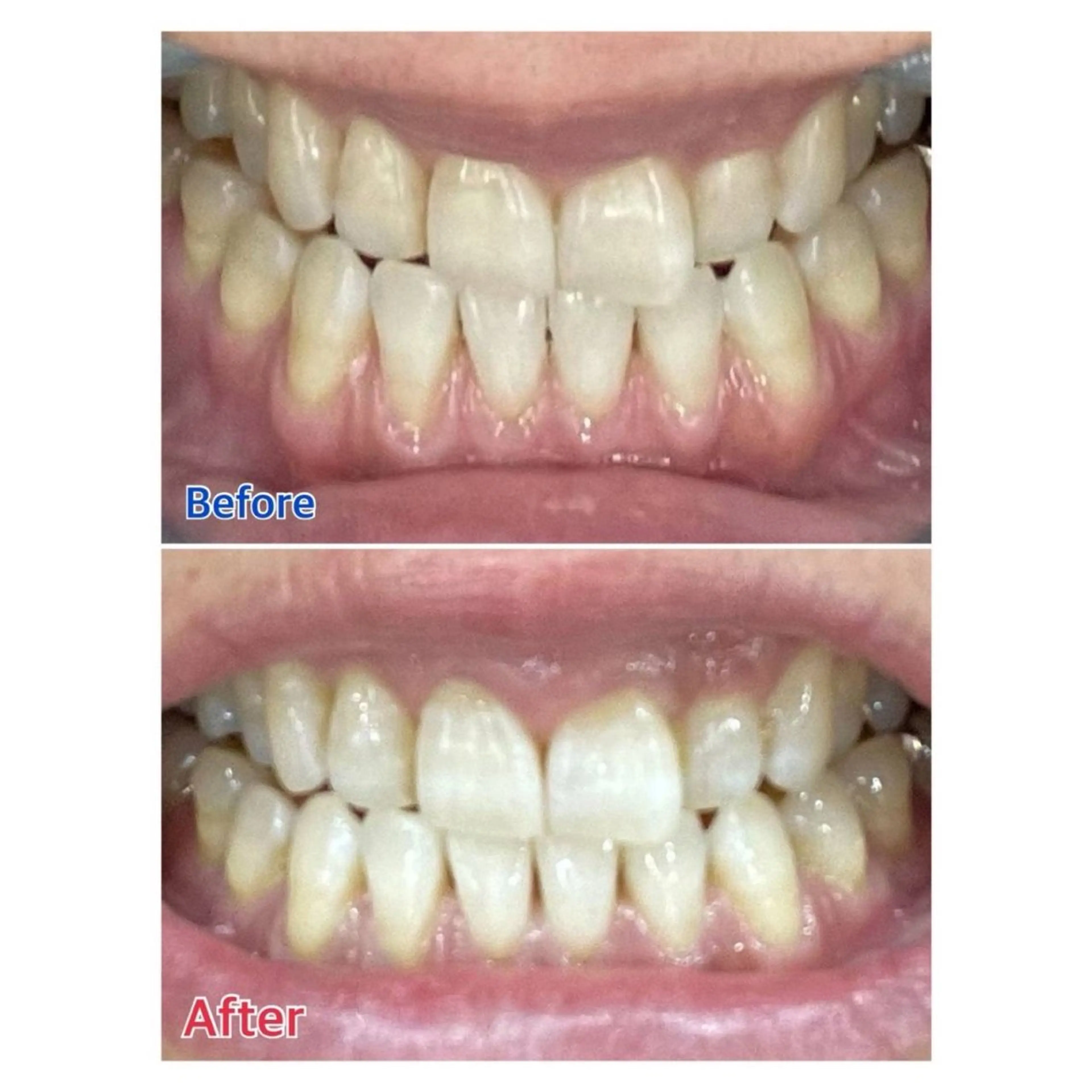 MBEAUTYSALON 千葉店・京成大久保所属・Melty 輝のその他イメージ