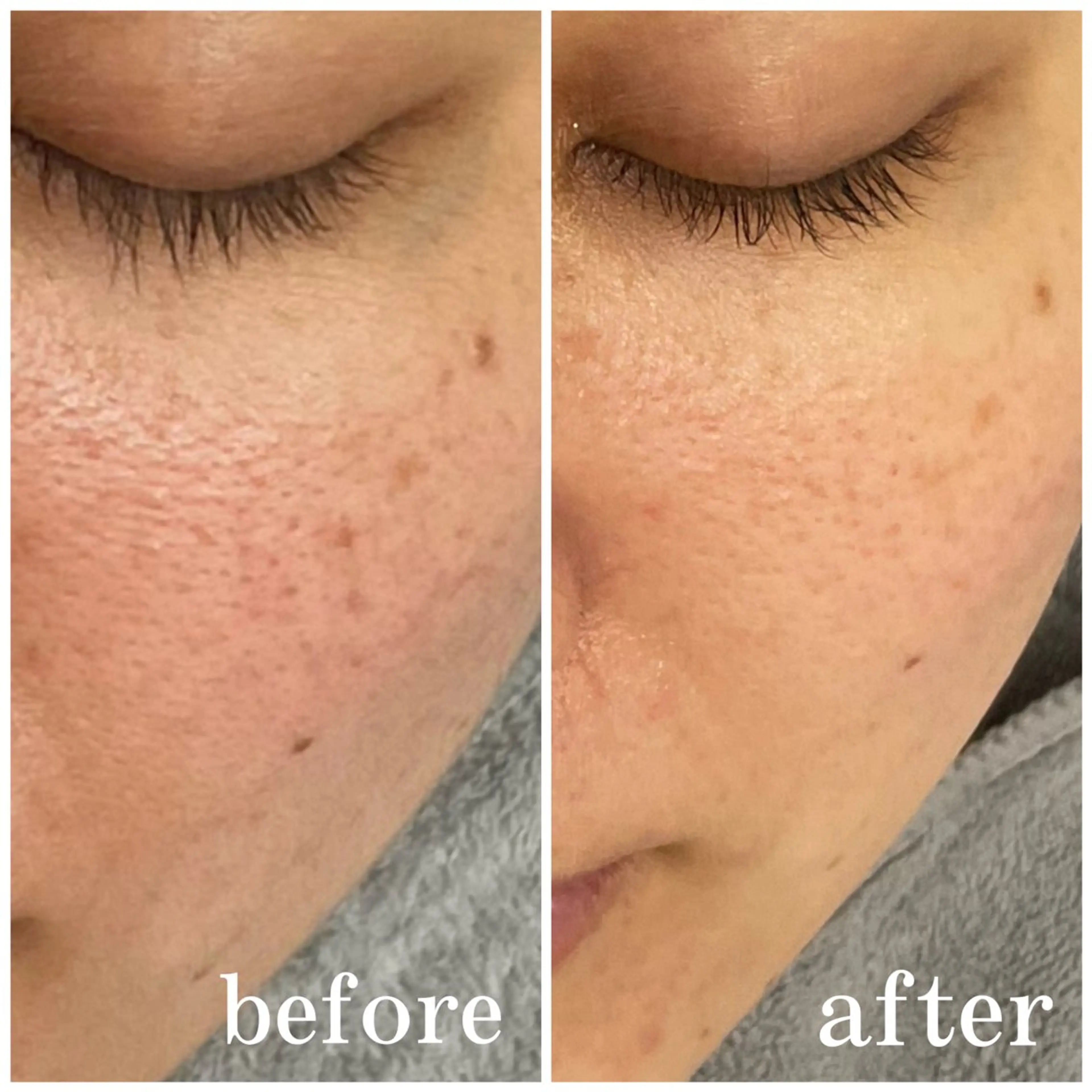 サロンピュア 所沢店のエステ・リラクイメージ