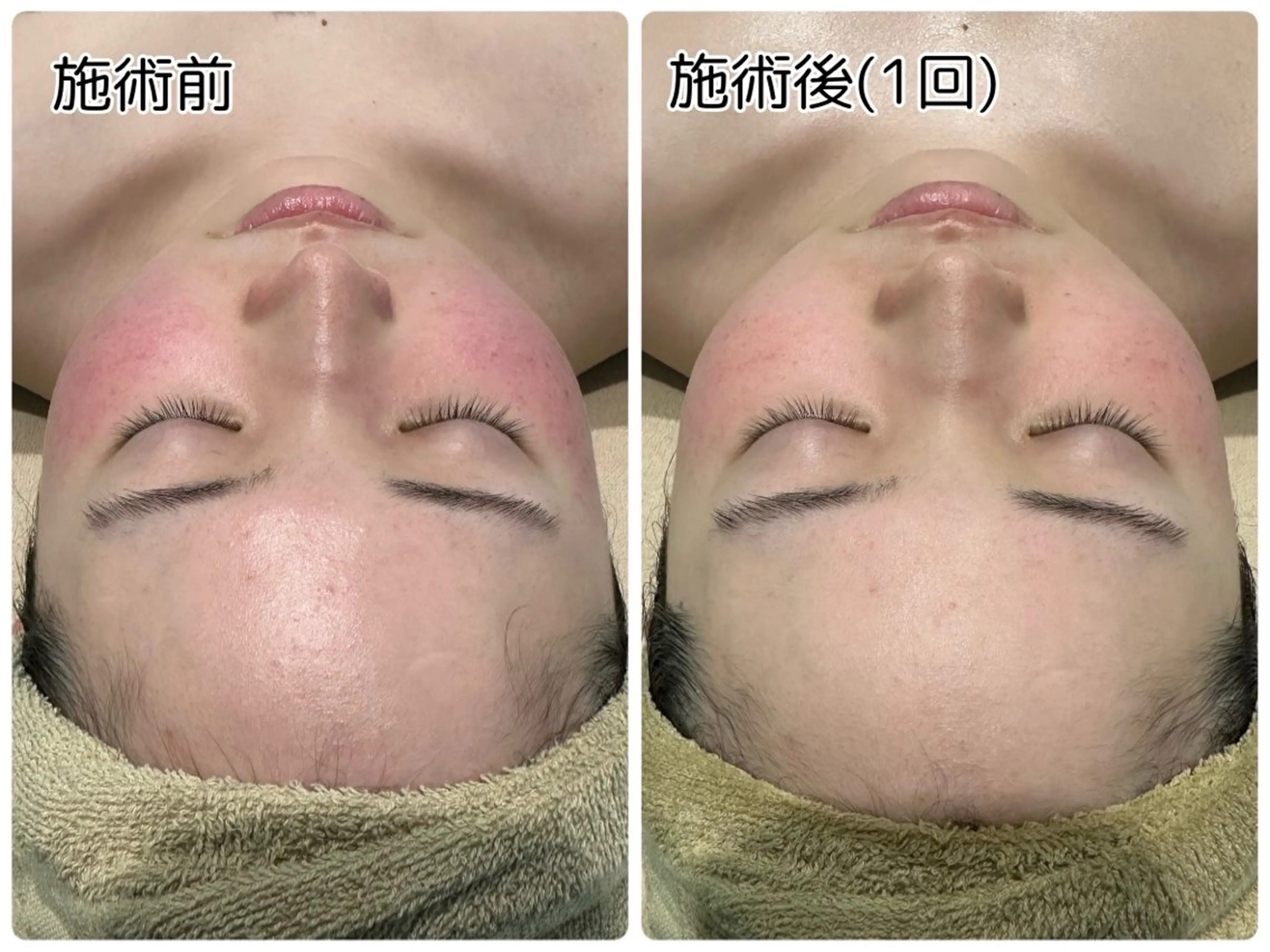 エステ リラク One .Erikaのエステ・リラクイメージ