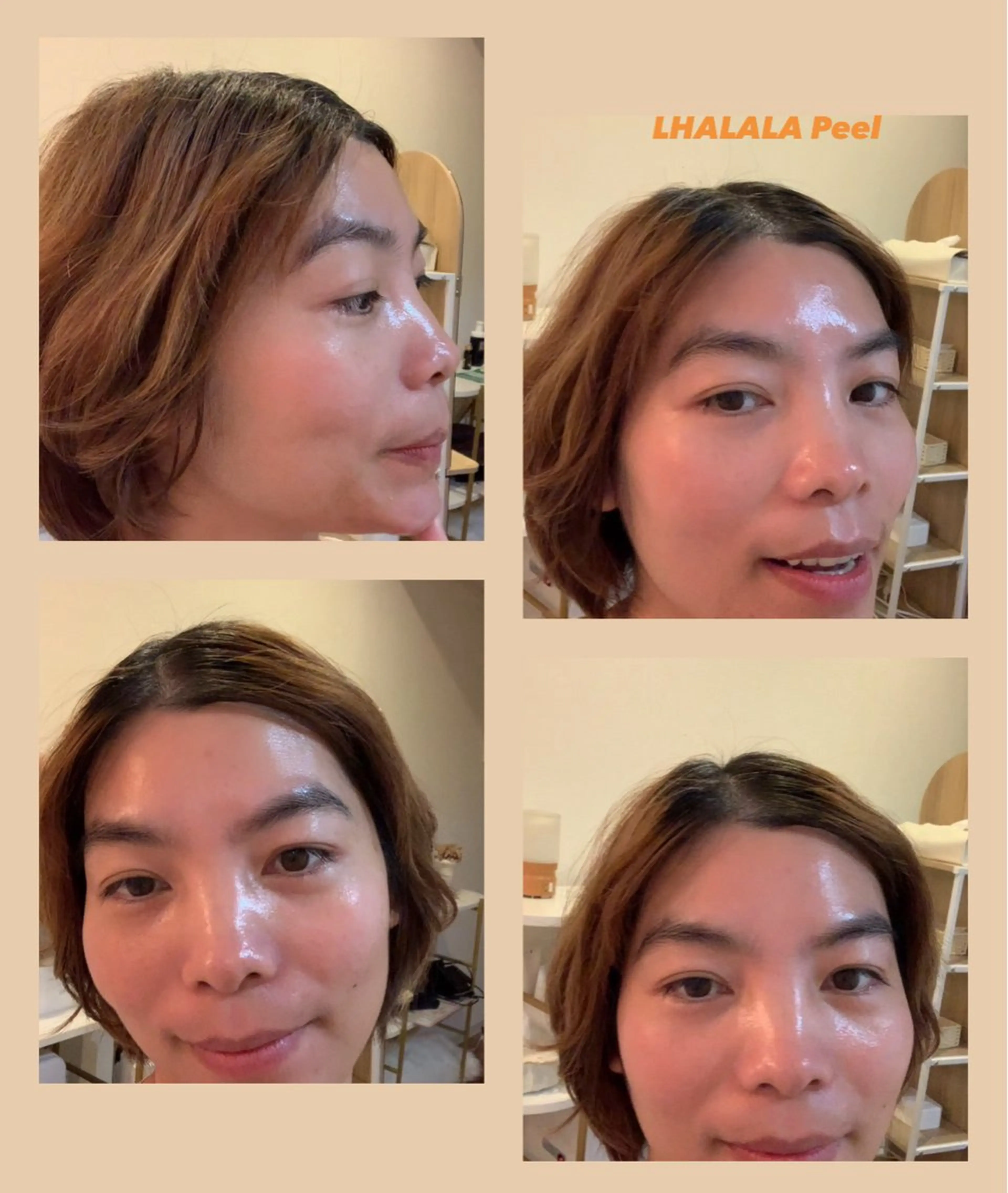 新メニュー　LHALALA total care(首​〜​お顔​〜​頭皮)の写真