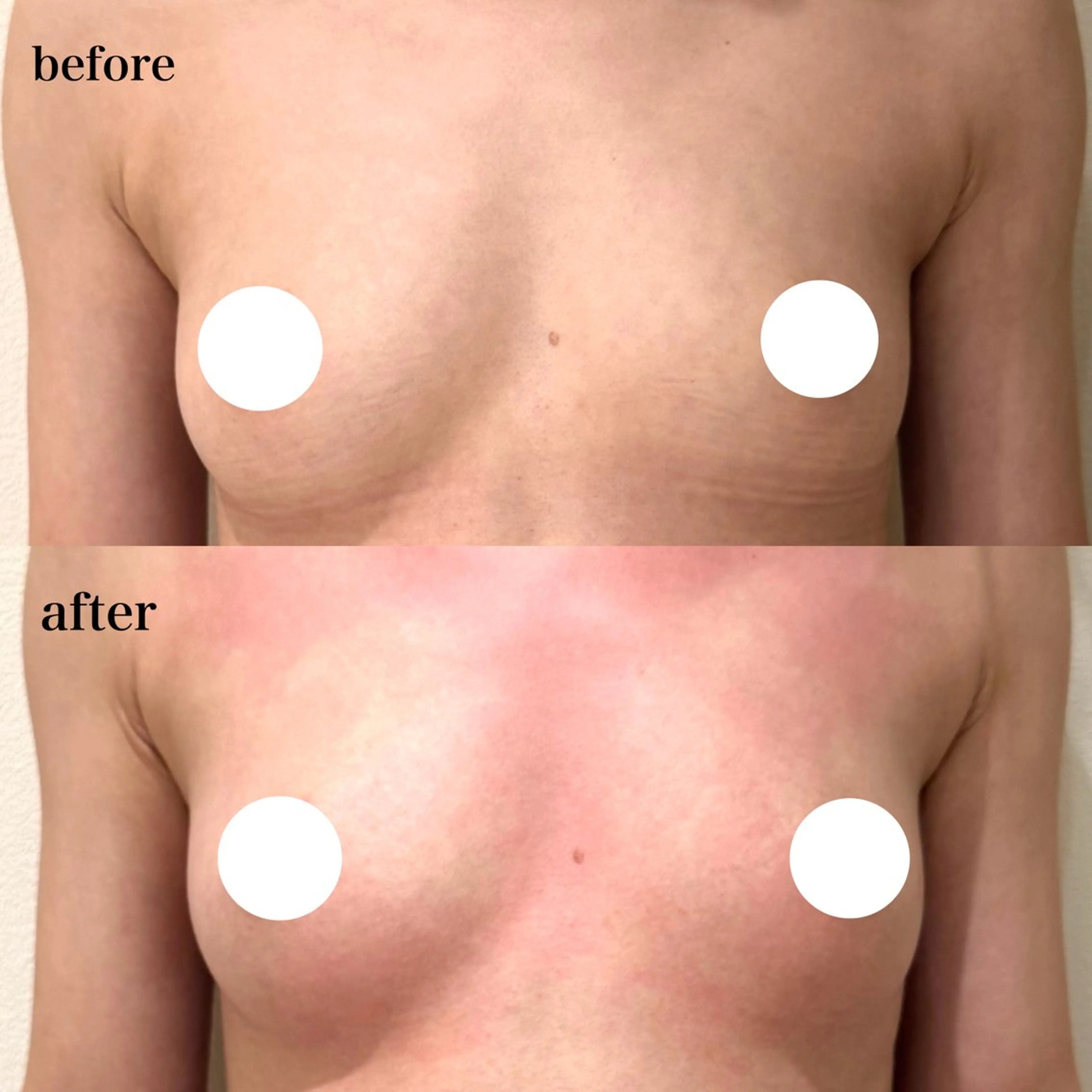 エステ beautysalon RAVIS所属・東大阪/韓国肌管理/ 痩身バスト専門店のエステ・リラクイメージ