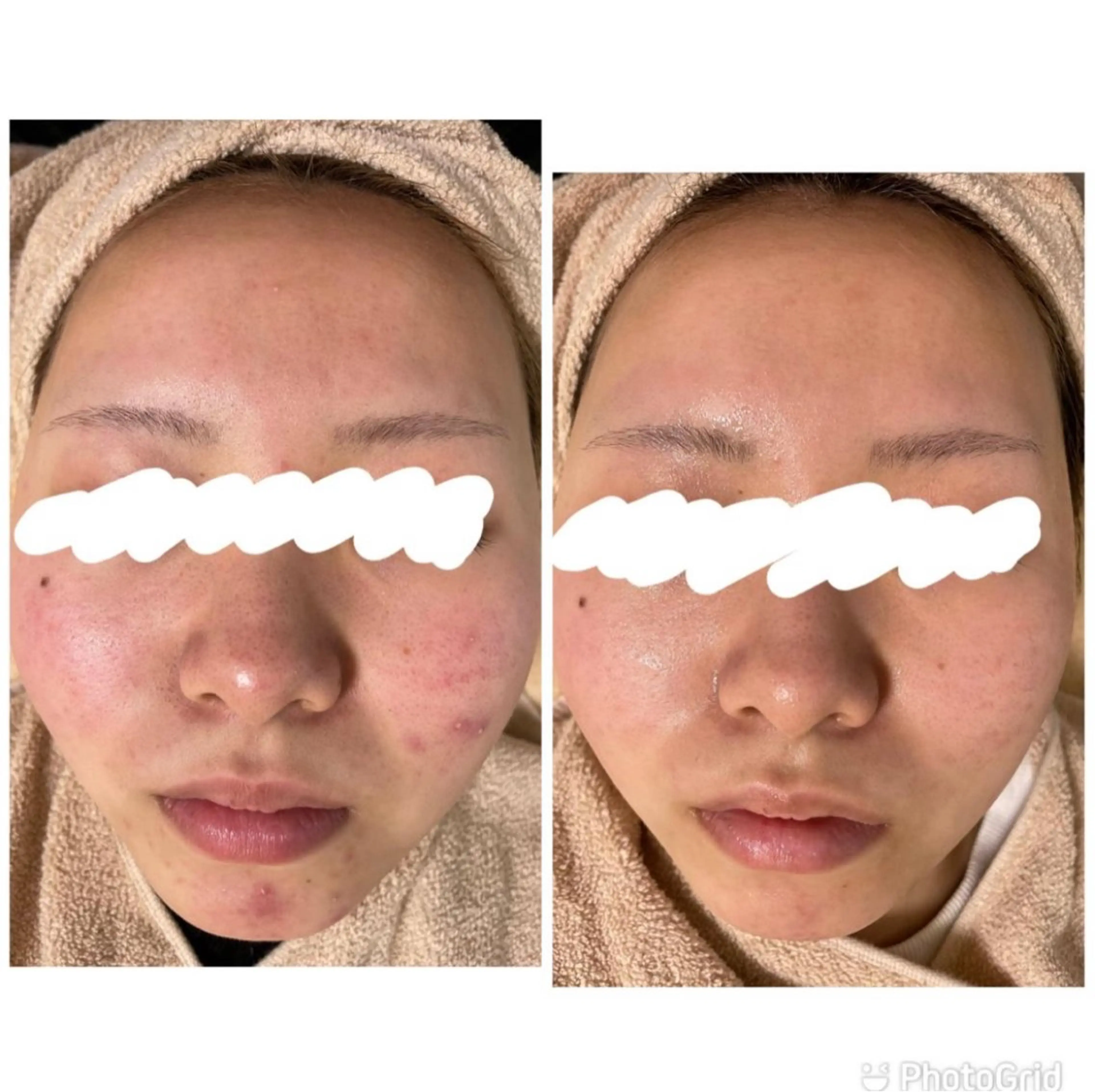 都度払い肌改善専門店 店長二上文香のエステ・リラクイメージ