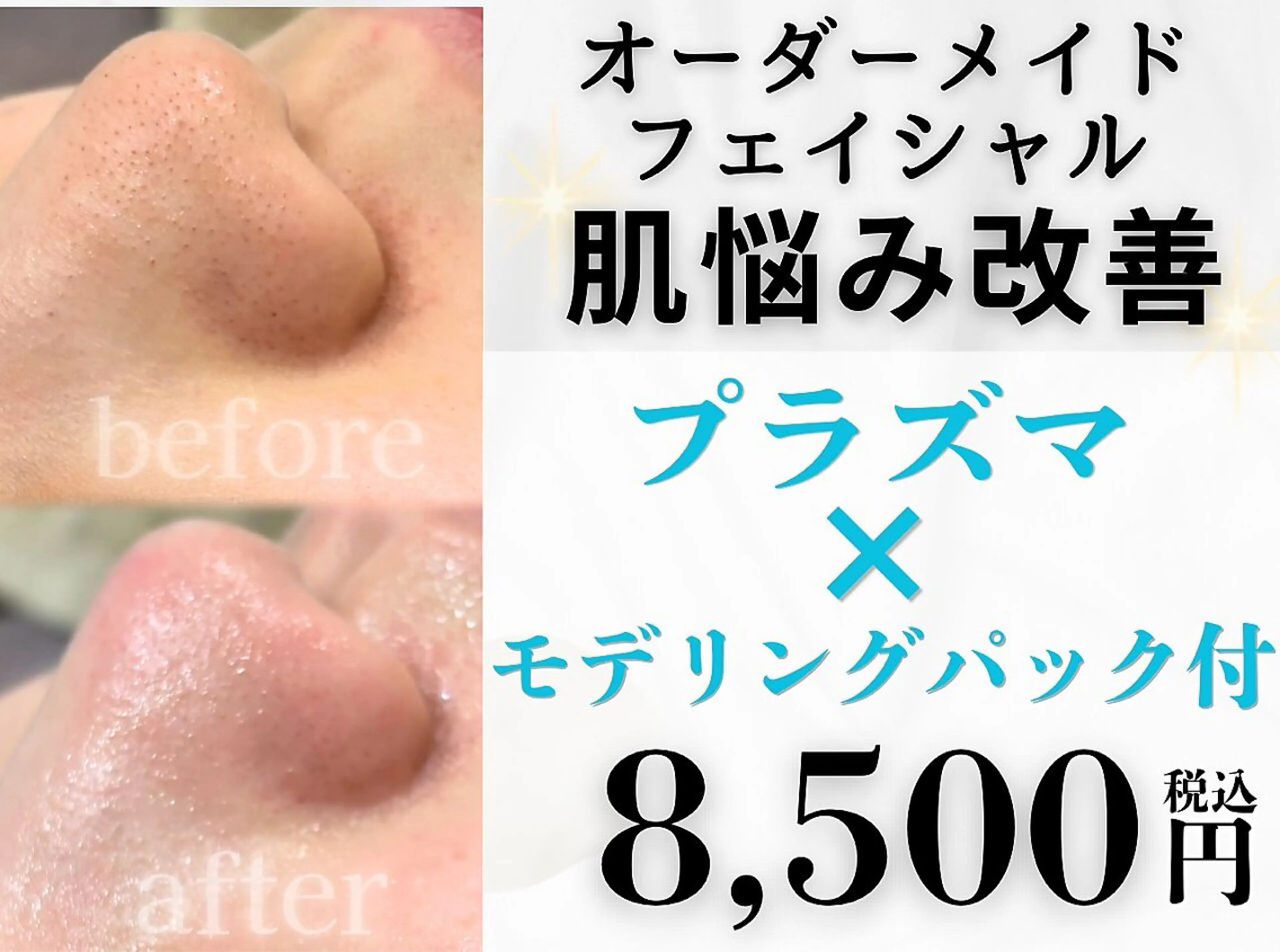 【導入記念】人気No.1プラズマ＋肌悩み別美容液導入＋モデリングパック付の写真