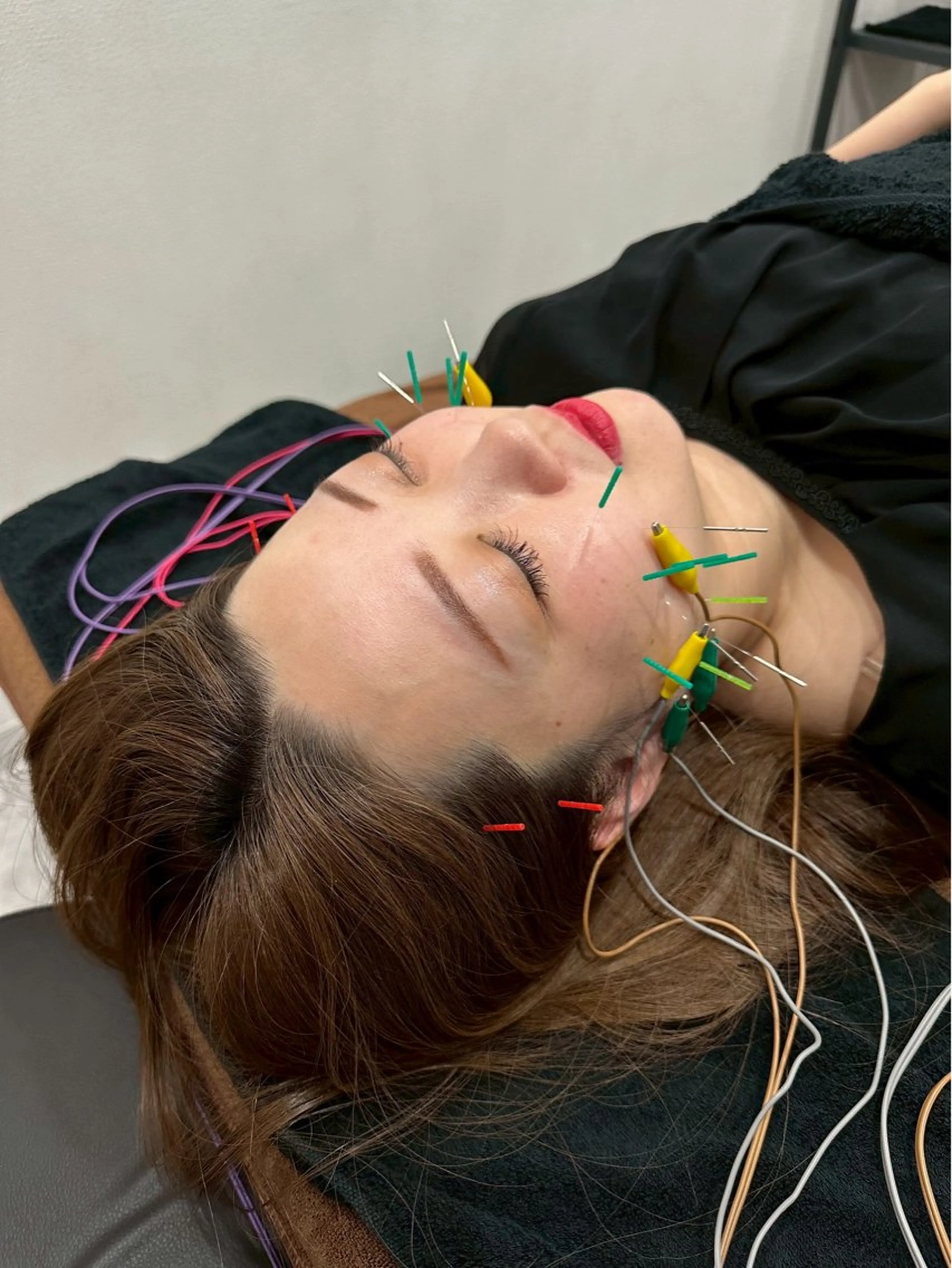 美容鍼・小顔矯正 FLOW 鍼灸整体院のその他イメージ