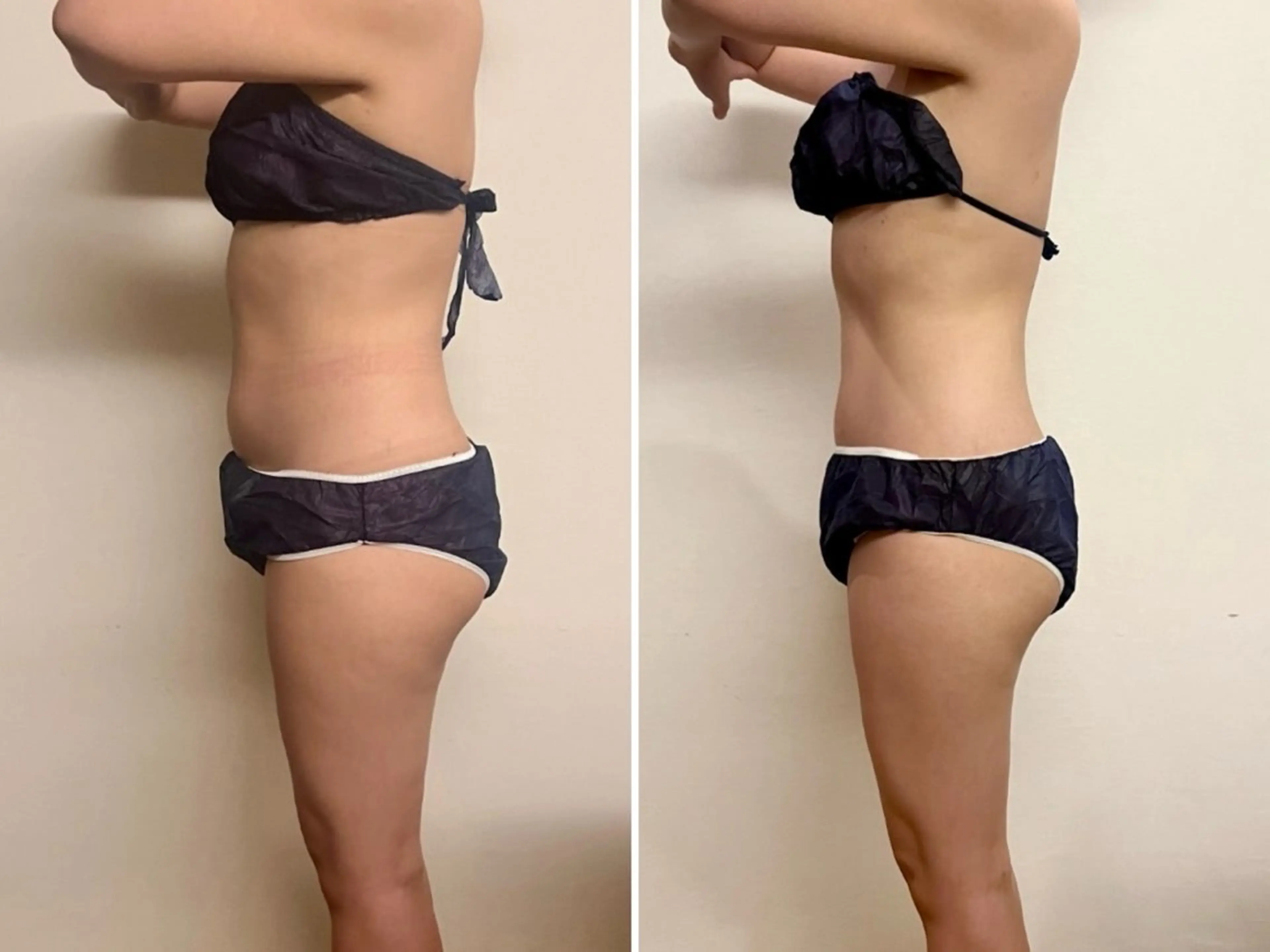 🌷ミニモ限定🌷⭐︎オールハンド【眠れる痩身エステ】90分の写真