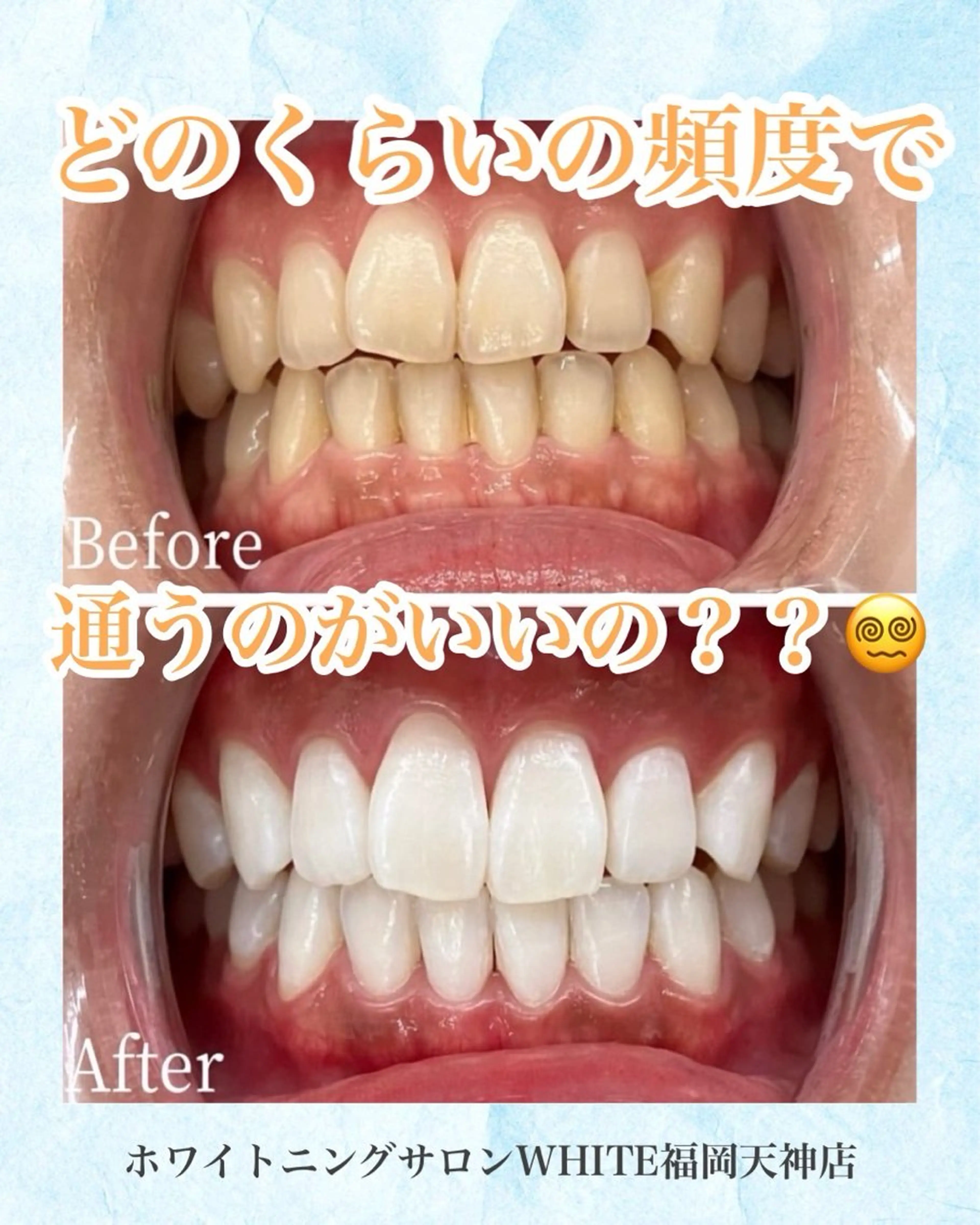 メンズ キッズ エステ リラク ホワイトニング専門店 WHITE天神店のエステ・リラクイメージ