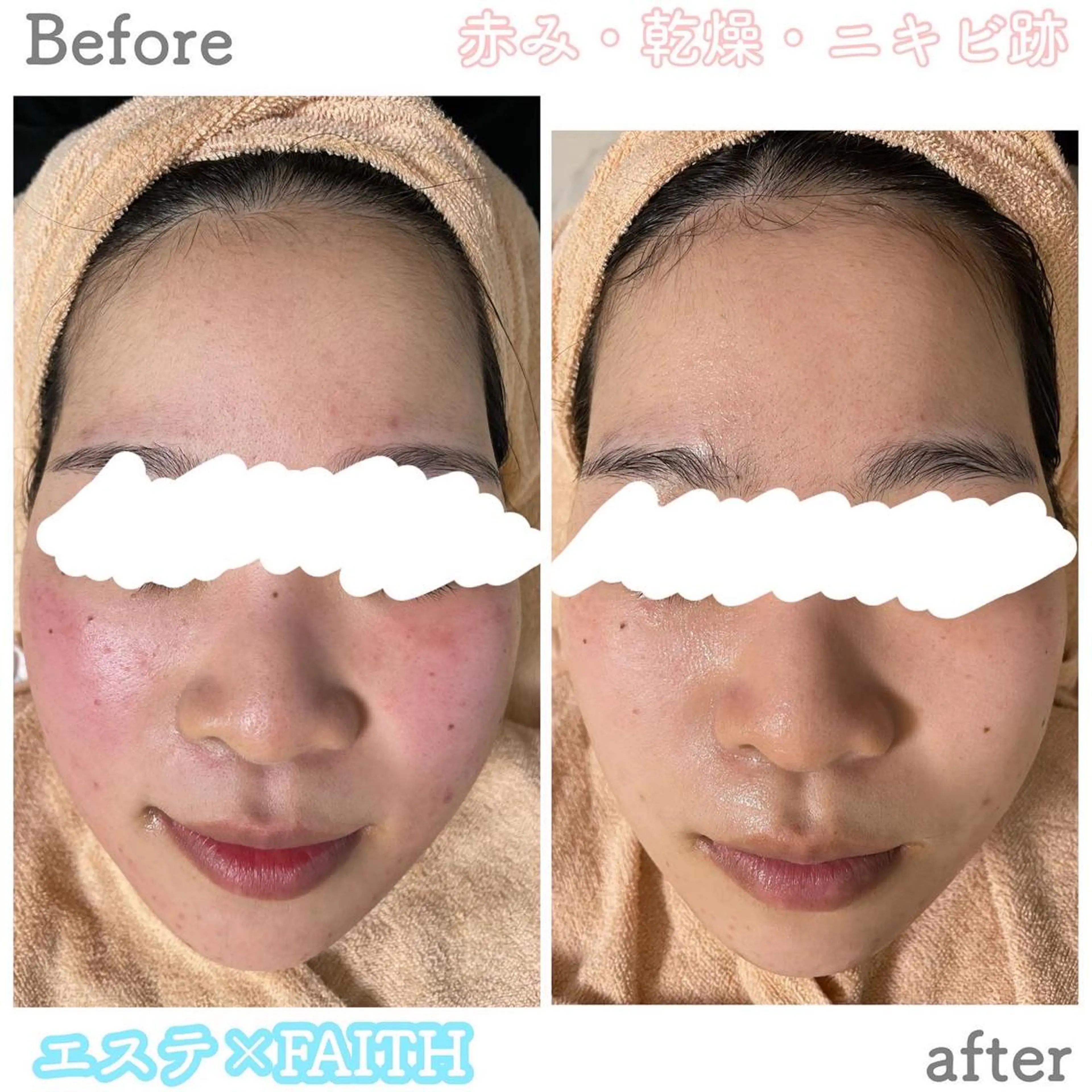 ショート カラー パーマ ヘアアレンジ メンズ キッズ ネイル マツエク・マツパ アイブロウ 赤色 エステ ニキビ&跡改善サロン オーナー光木のエステ・リラクイメージ