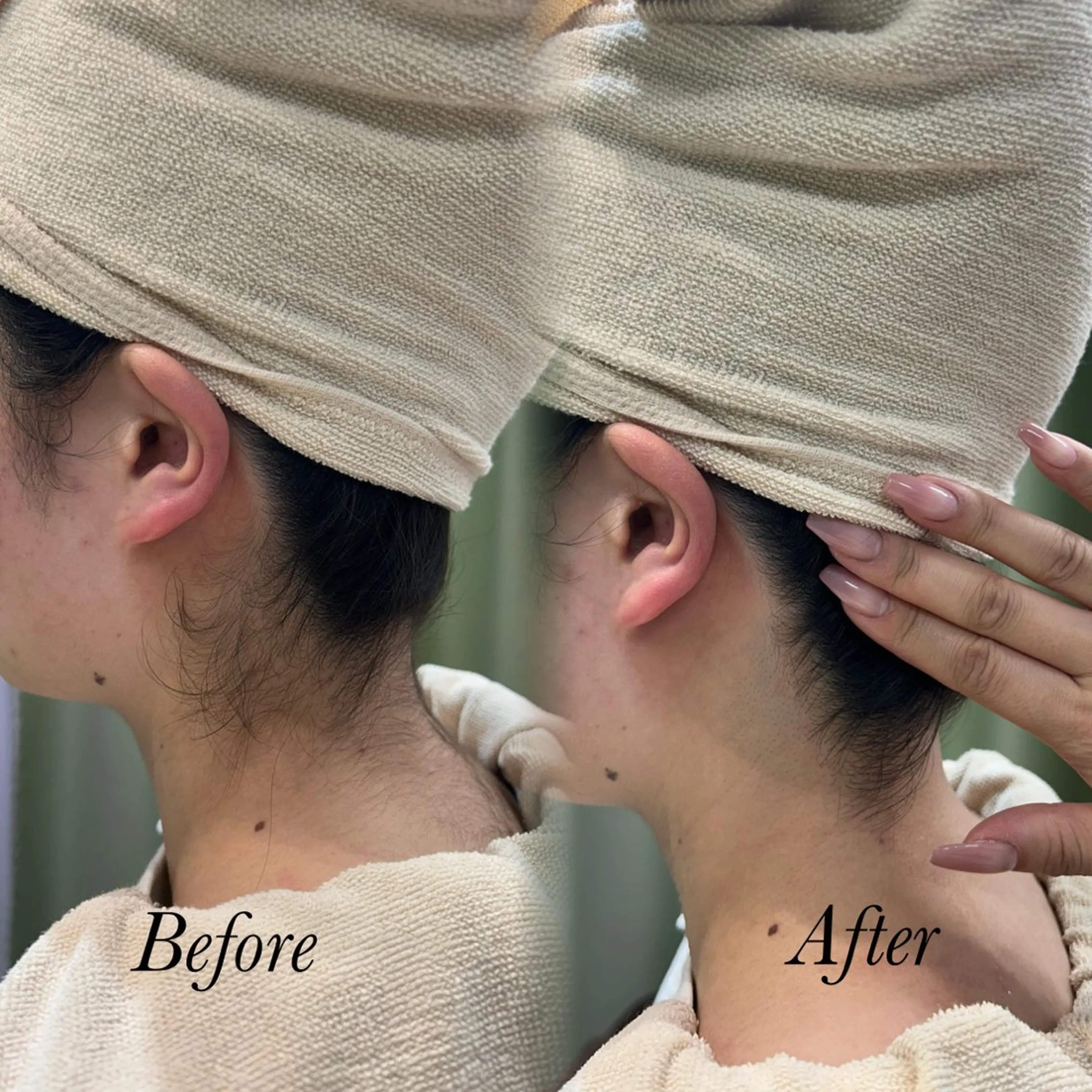 その他 🫧美しい素肌へ🫧 今成柚乃のその他イメージ