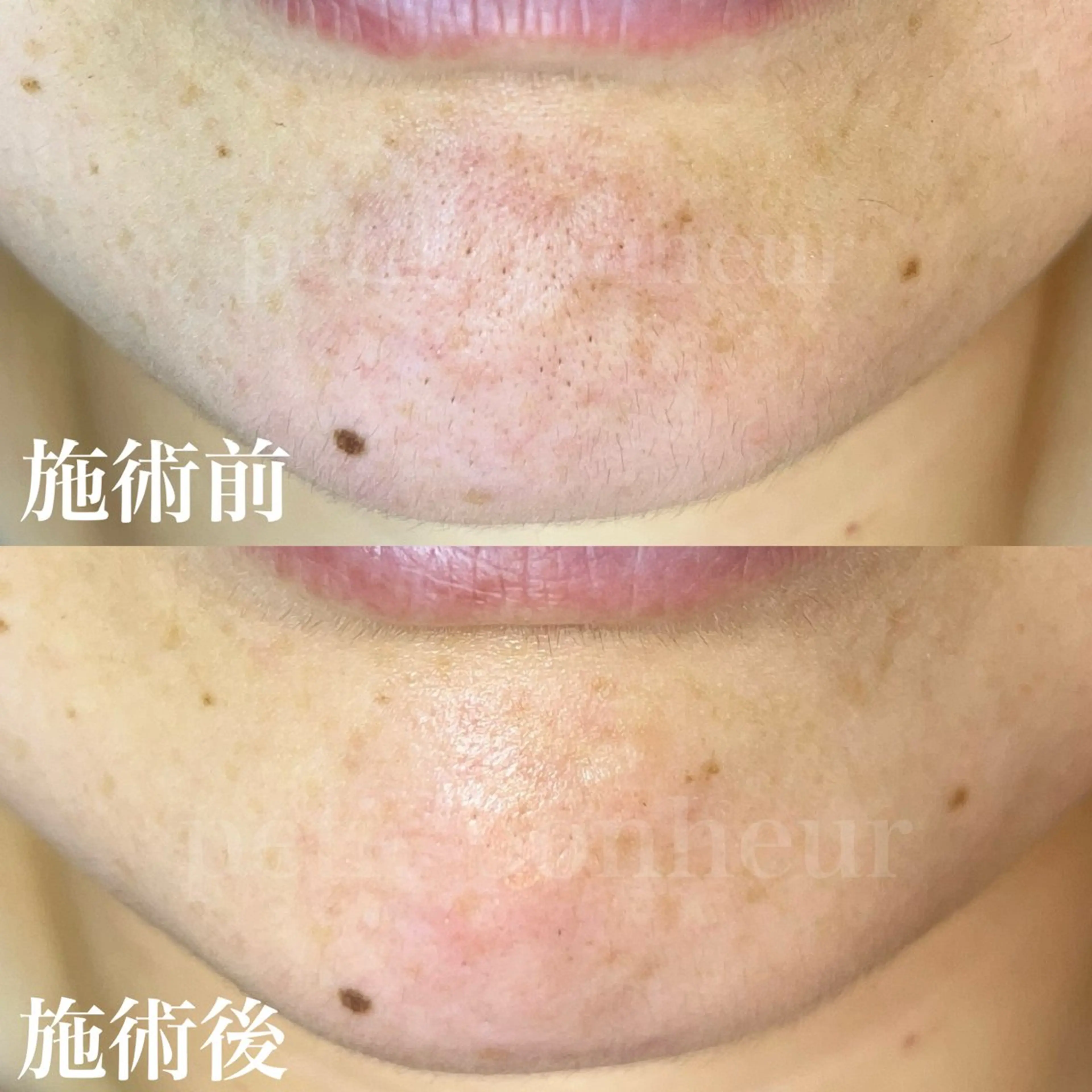 エステ 槙谷 あさみのエステ・リラクイメージ